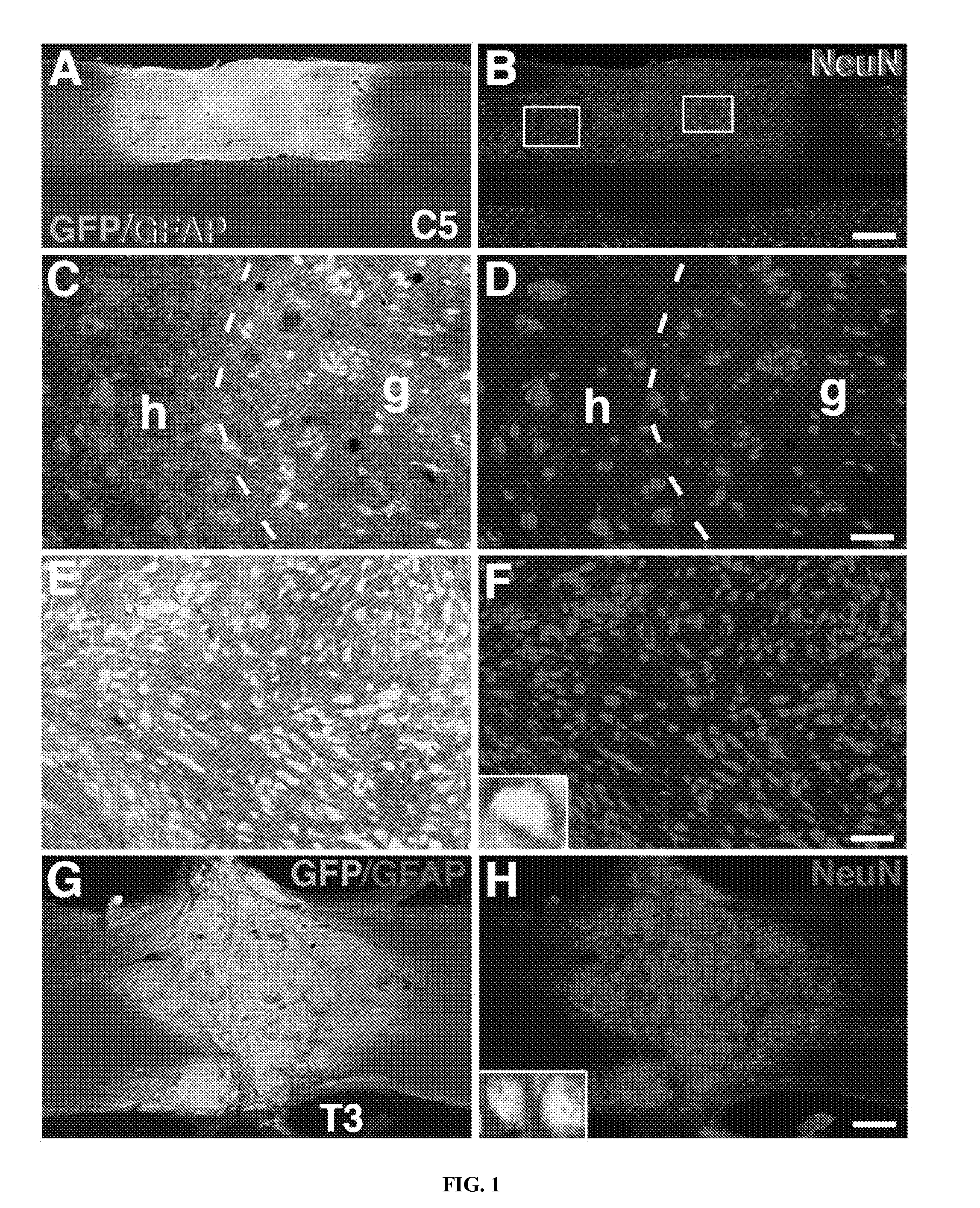 Methods for Use of Neural Stem Cell Compositions for Treatment of Central Nervous System Lesions