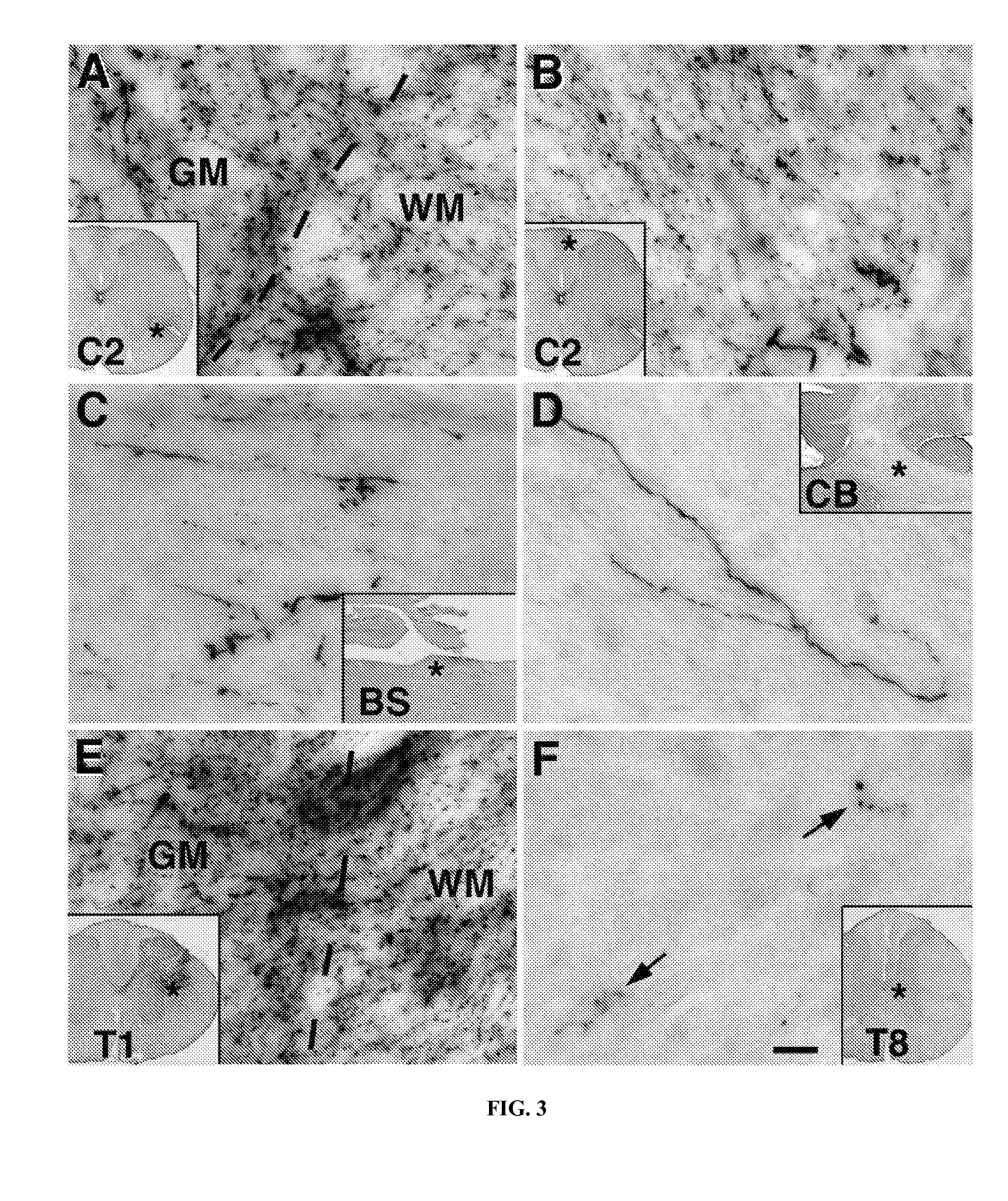 Methods for Use of Neural Stem Cell Compositions for Treatment of Central Nervous System Lesions