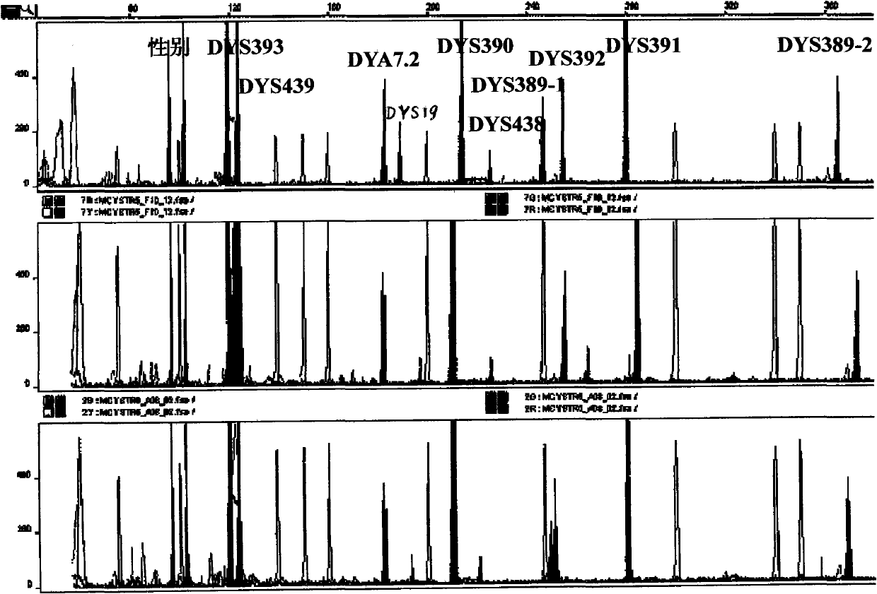 Y-STR locus fluorescent label multiplex amplification system and application thereof