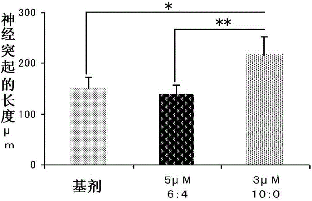 Ophthalmic composition containing geranylgeranylacetone