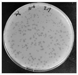 Staphylococcus aureus phage strain and application thereof