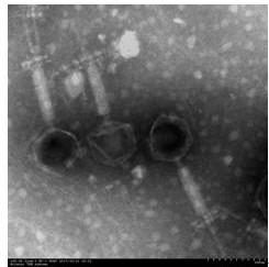 Staphylococcus aureus phage strain and application thereof