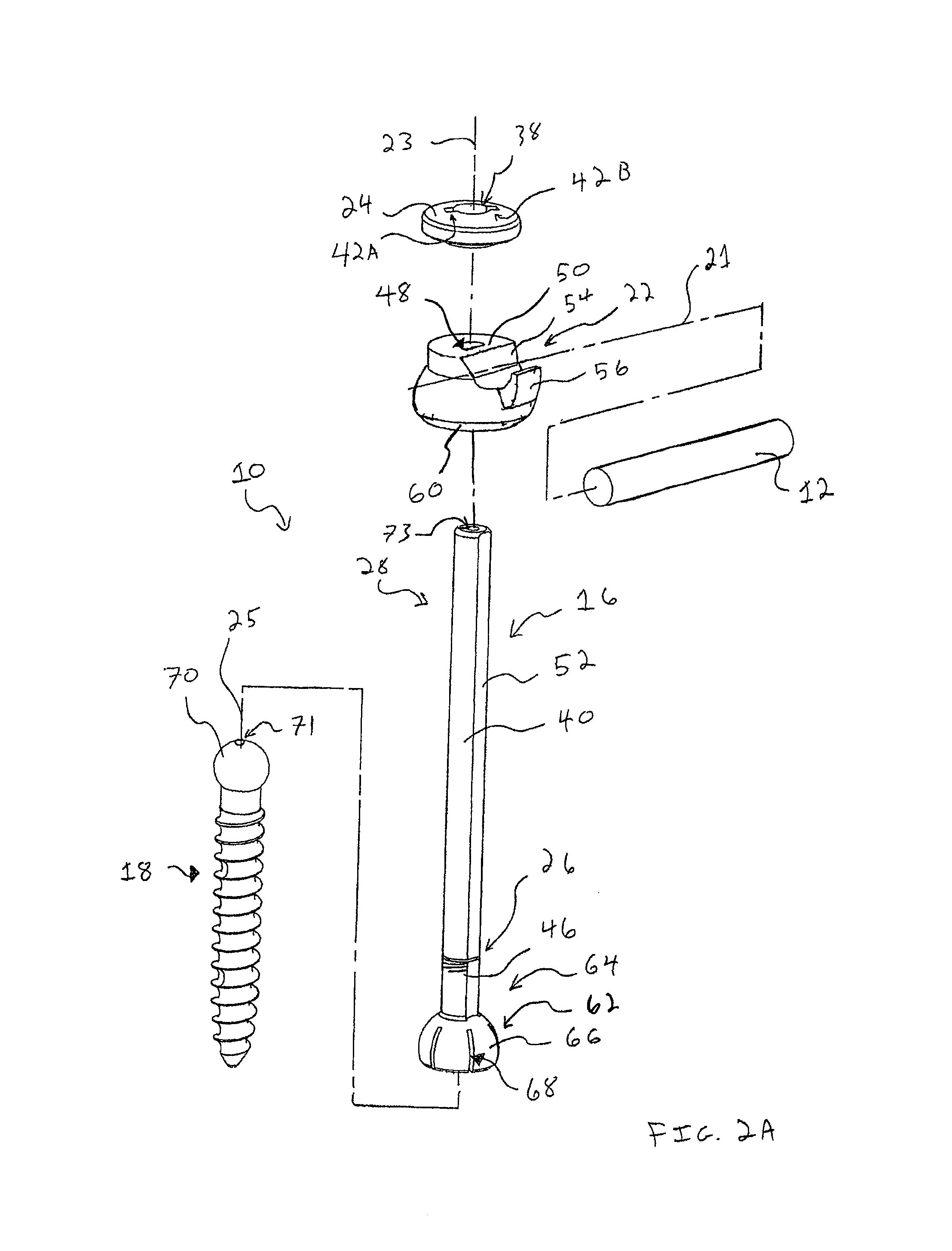 Spinal fixation system and method