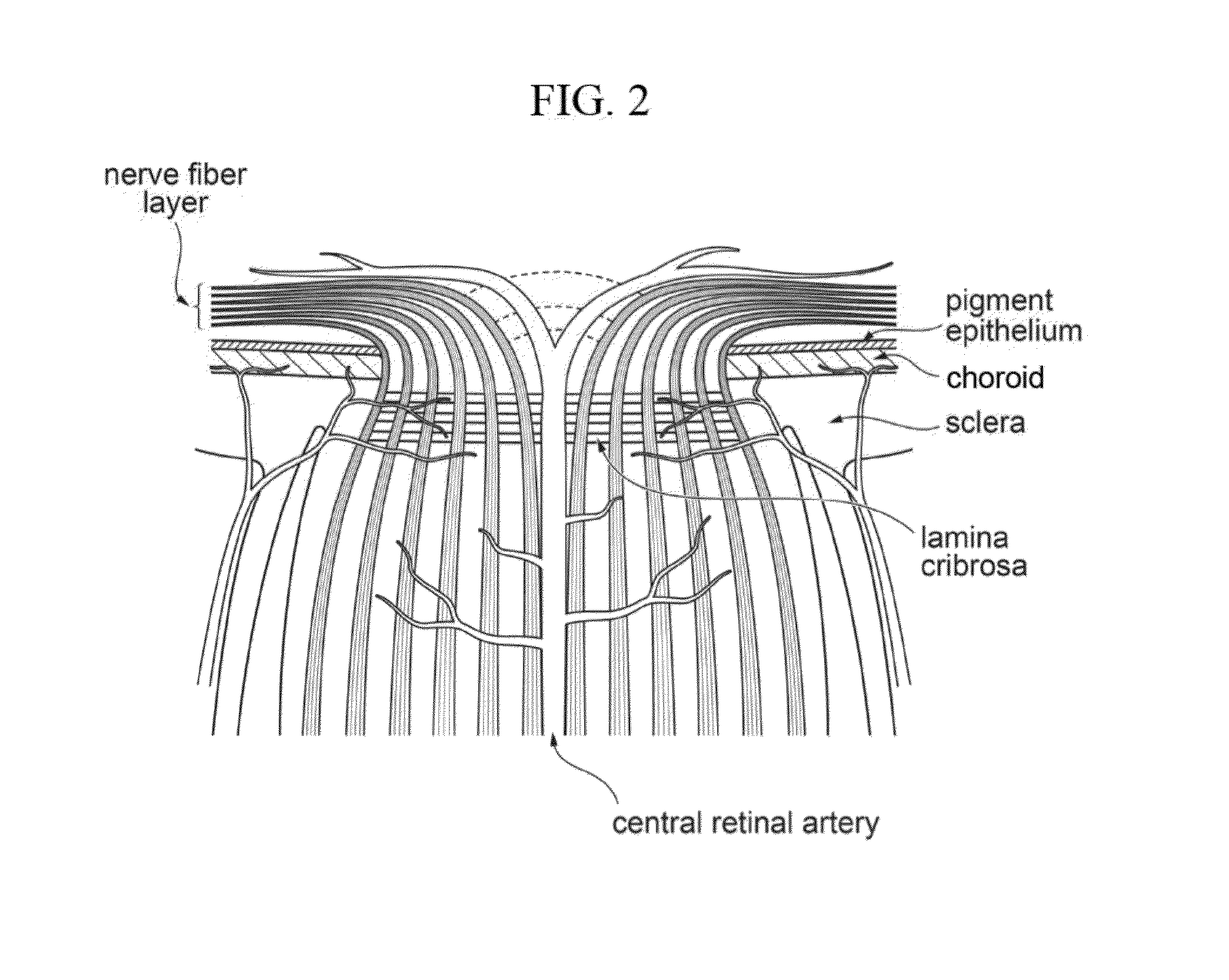 Method for diagnosing glaucoma by observing connective tissue of lamina cribrosa