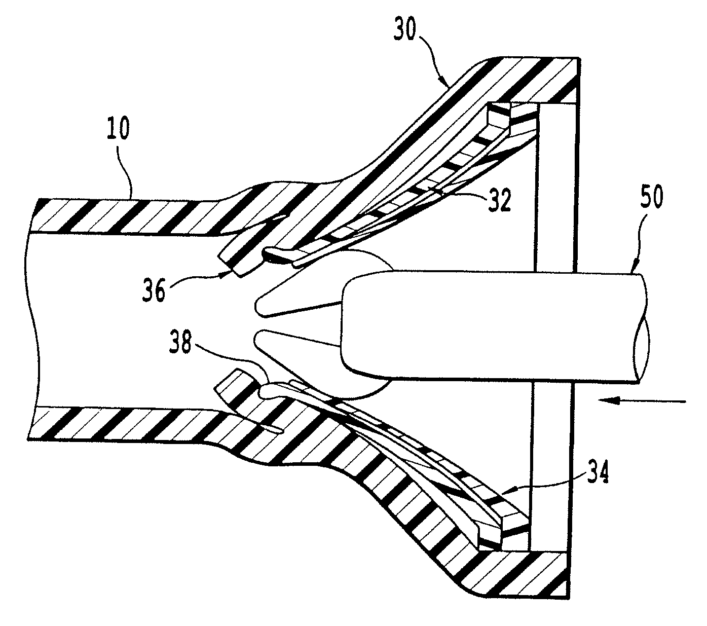 Double-cone sphincter introducer assembly and integrated valve assembly