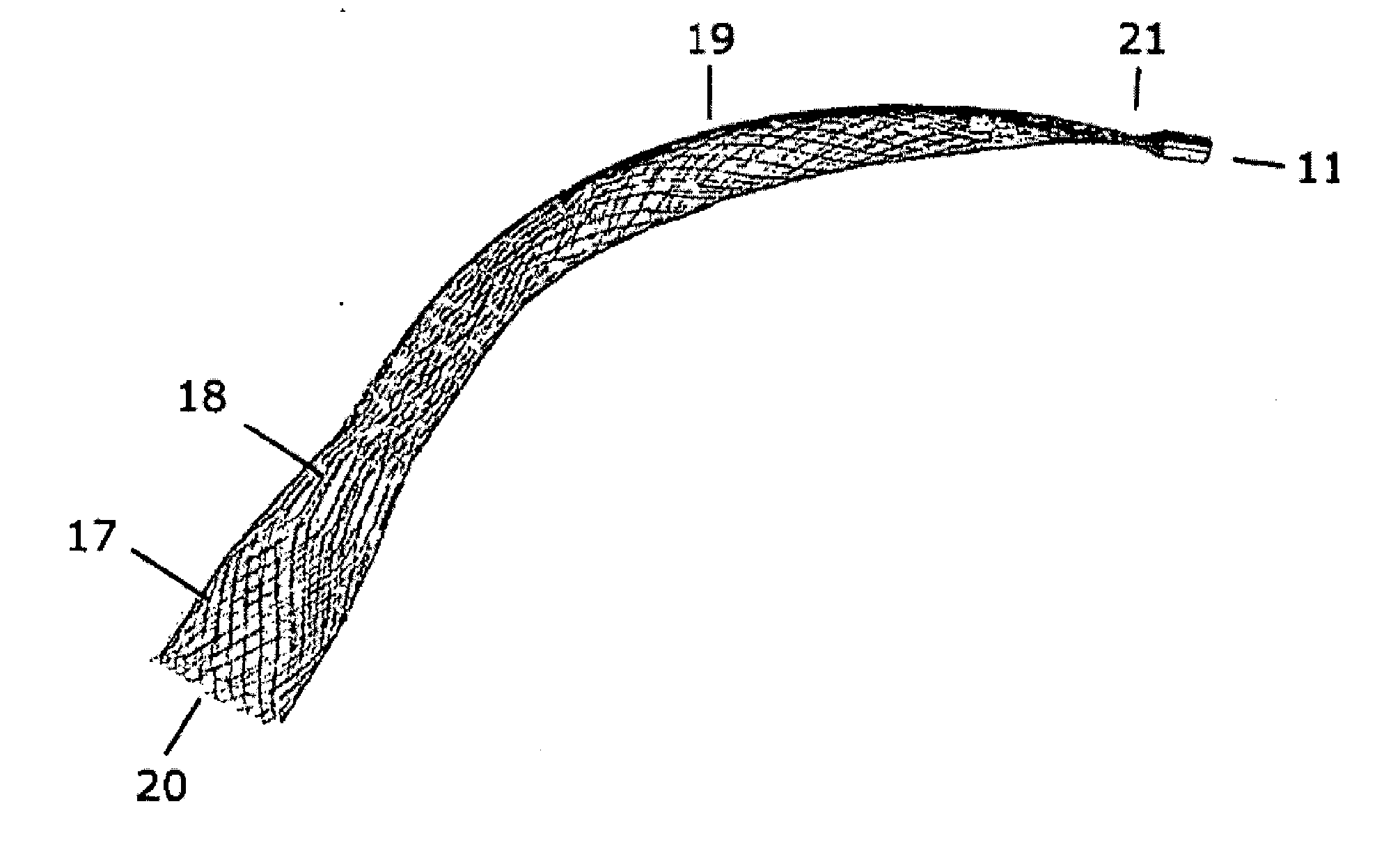 Device for splinting a cavity, organ duct and/or vessel