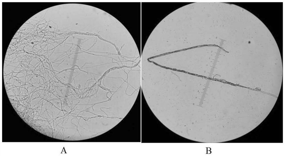 A kind of Pseudomonas dispora strain and its breeding method