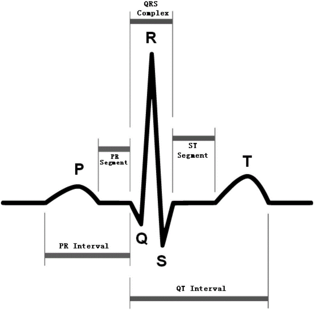 Electrocardiosignal classification method and device