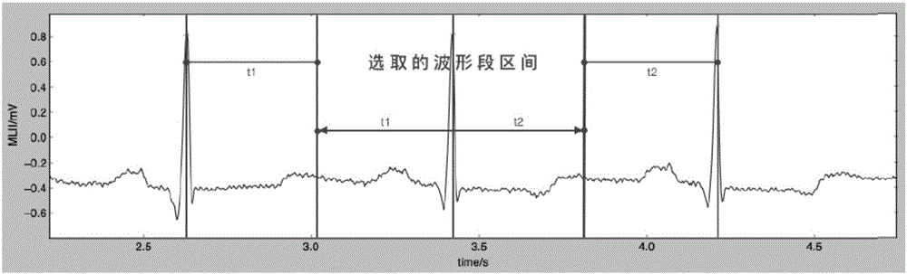 Electrocardiosignal classification method and device
