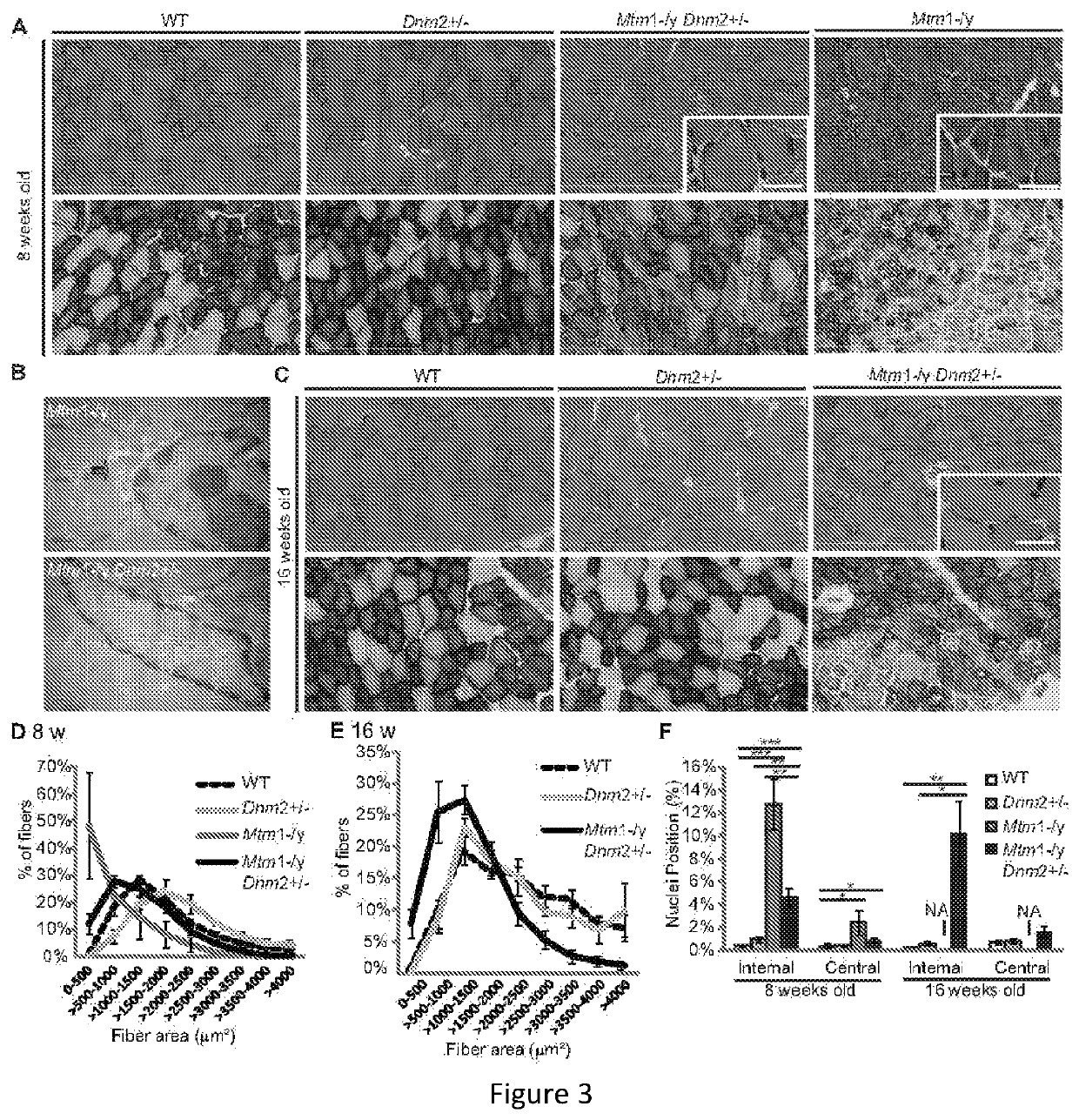 Dynamin 2 inhibitor for the treatment of centronuclear myopathies