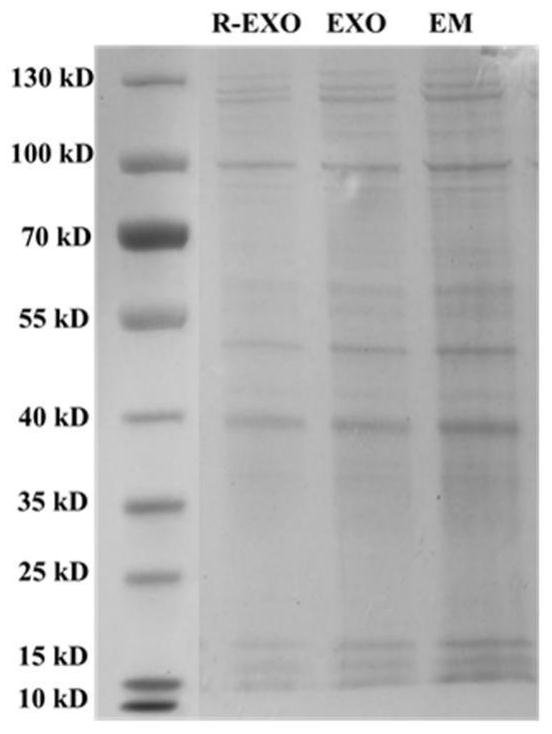 Homologous recombination exosome multi-drug delivery bionic nanoparticles as well as preparation method and application thereof