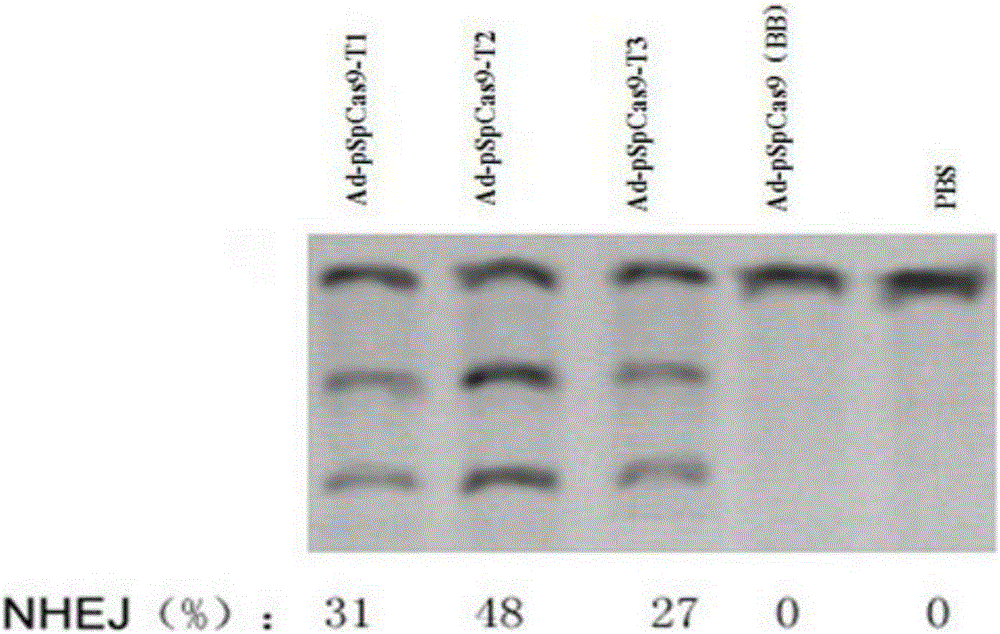 Targeted knockout vector containing CRISPR/Cas9 system and its adenovirus and application