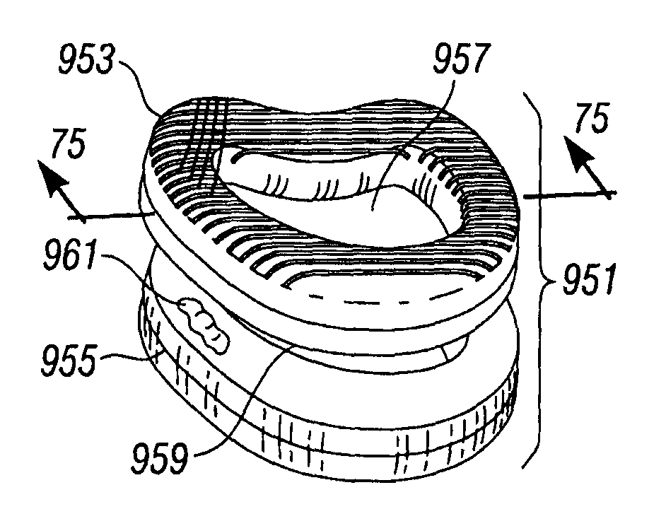 Spinal fusion instrumentation, implant and method