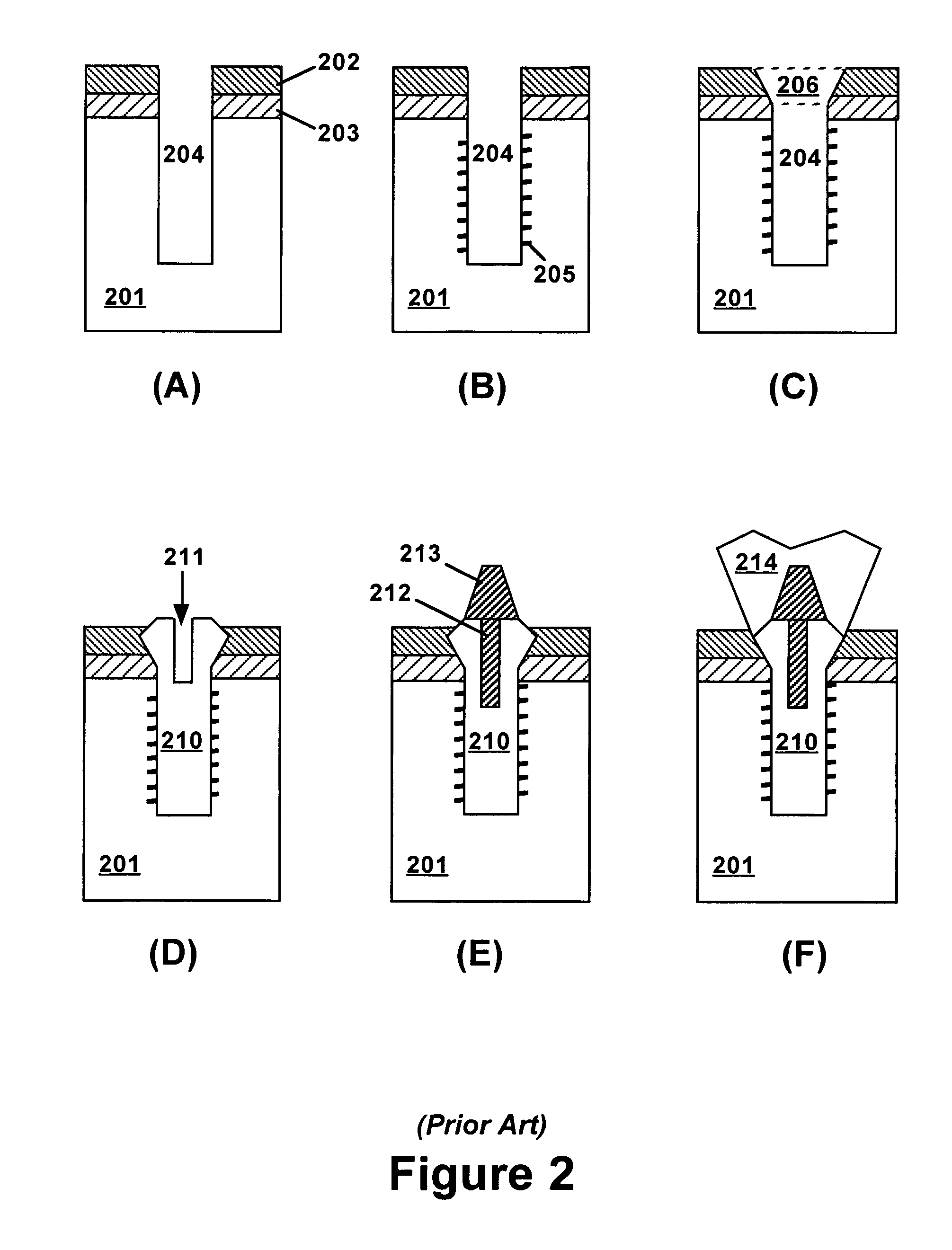 Apparatus and method for vertical positioning of dental implants