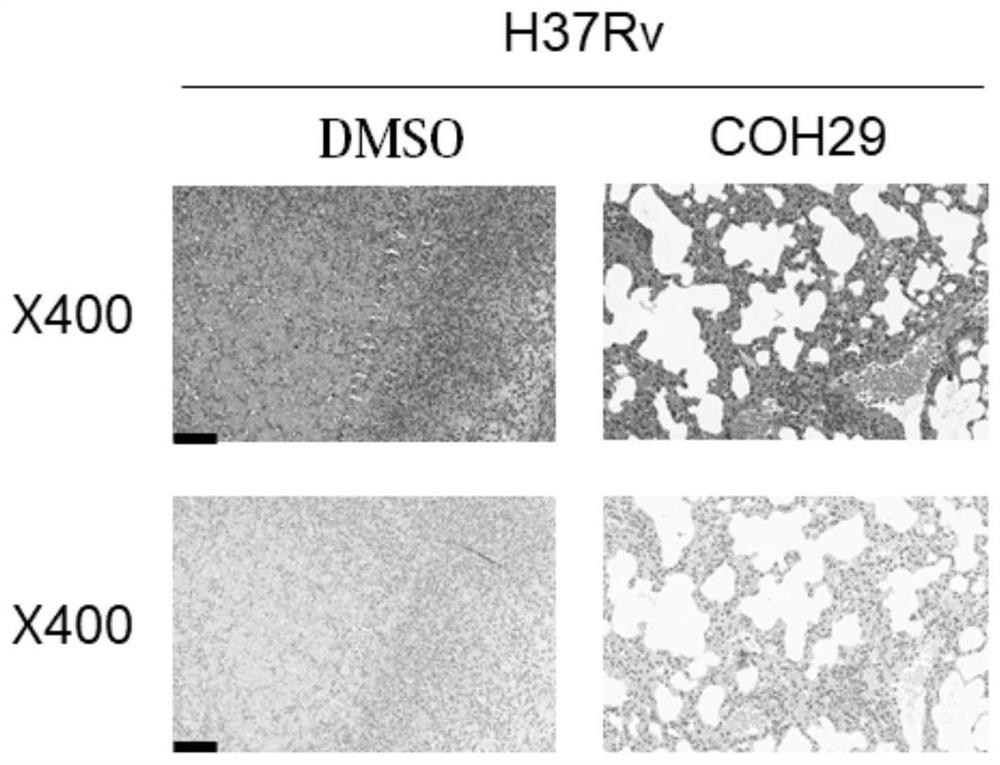 Application of dihydroxybenzamide derivative in preparation of SerC inhibitor and antituberculous drug