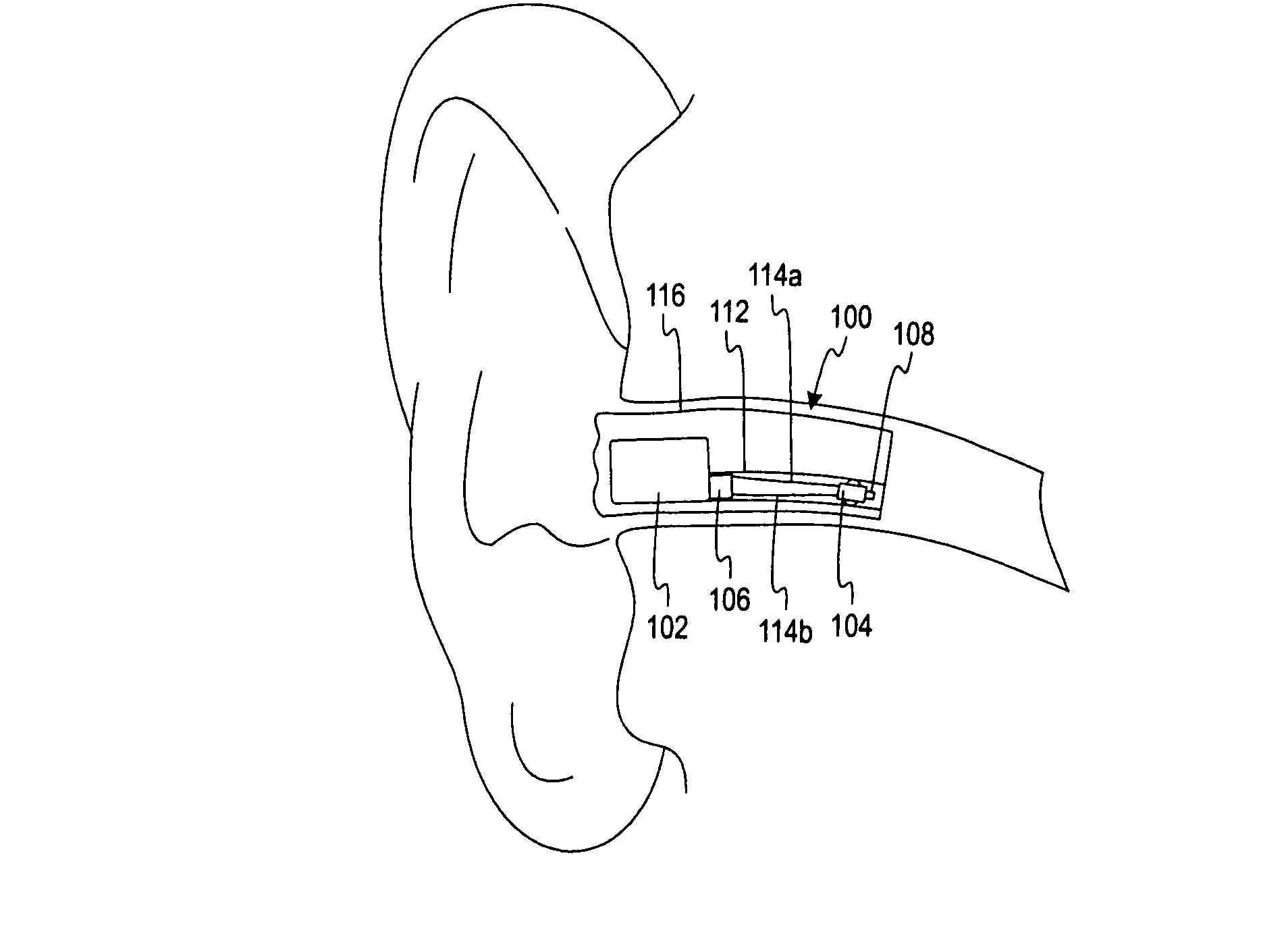 Hearing aid having two receivers each amplifying a different frequency range
