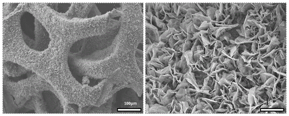 Flake NiXP/Ni negative electrode material for sodium-ion battery and preparation method of flake NiXP/Ni negative electrode material