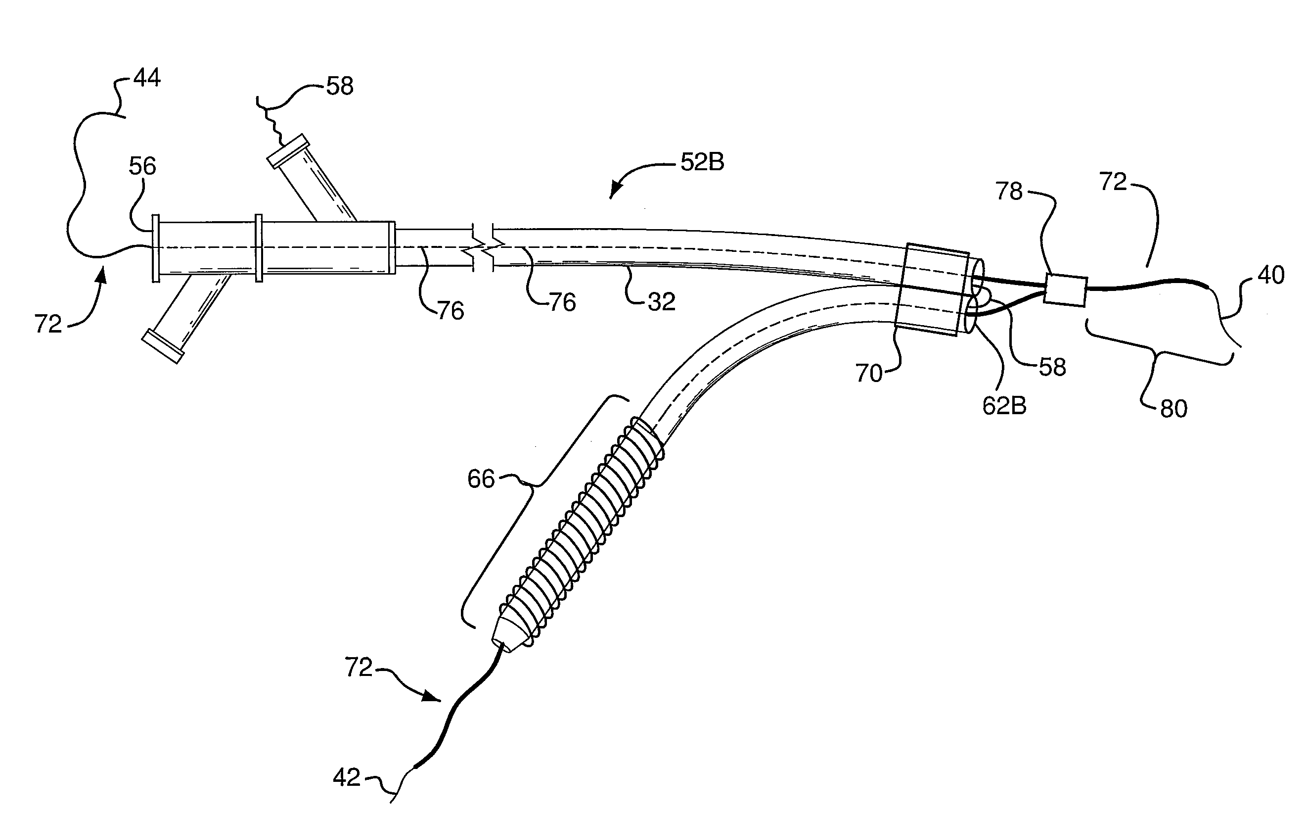 Branched stent delivery system