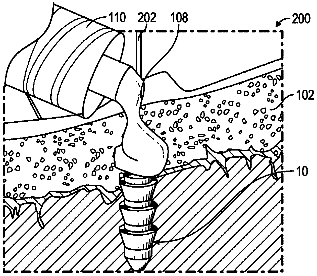 In-situ curing biodegradable anchor with reinforcement