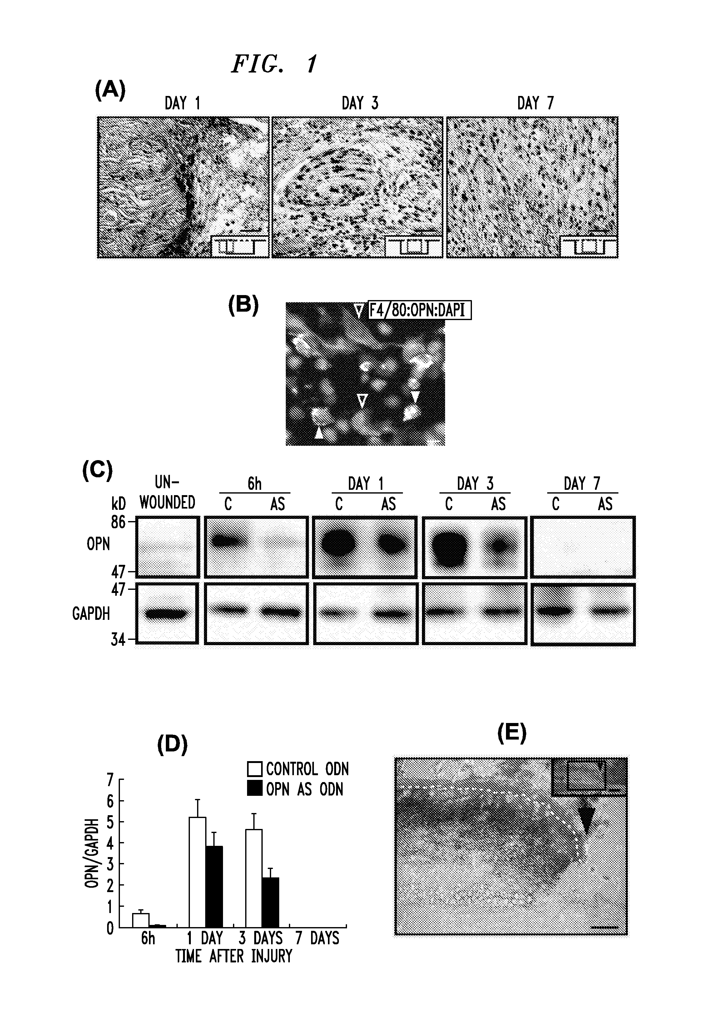 Wound healing compositions and treatments