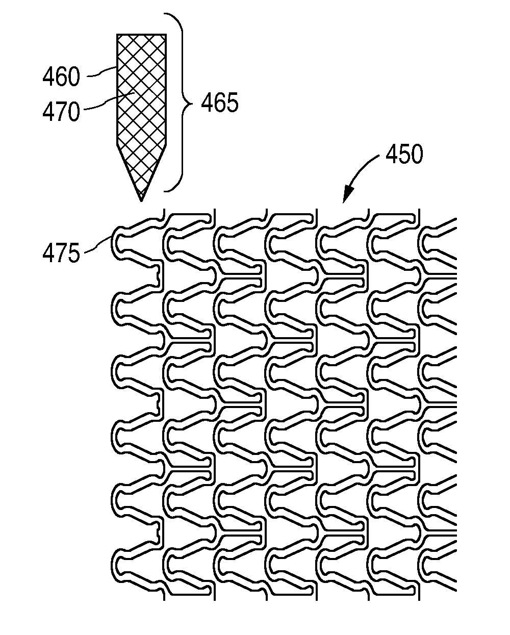 Medical Device with Regioselective Structure-Property Distribution
