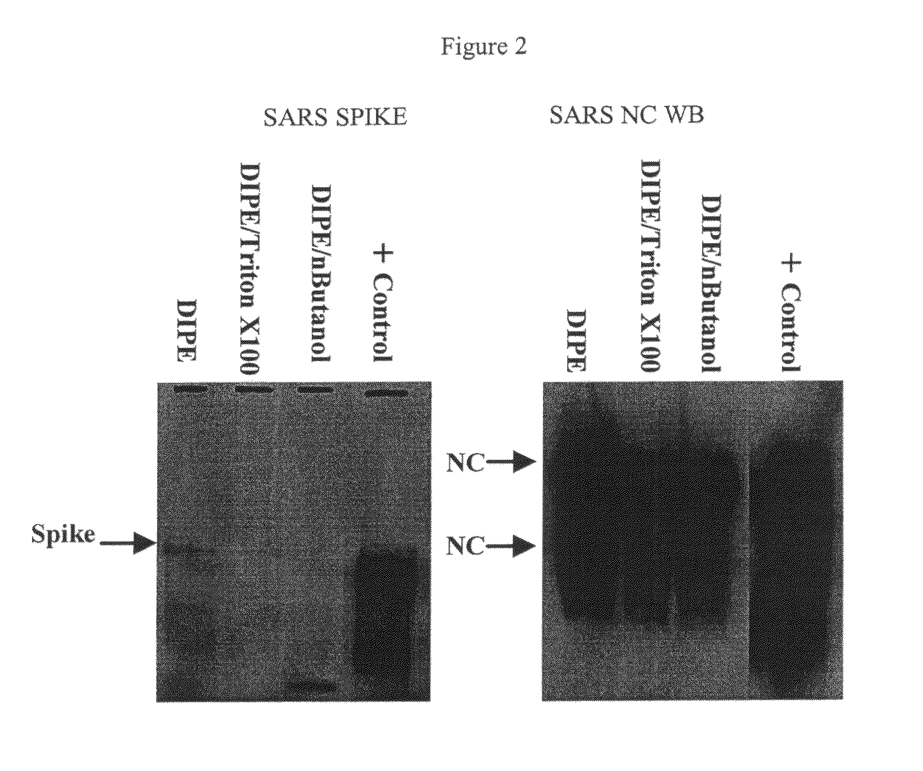 SARS vaccine compositions and methods of making and using them