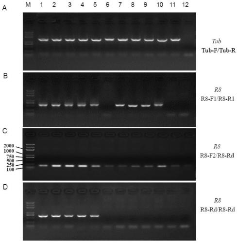 Potato late blight resistance gene diagnosis primers and design method thereof