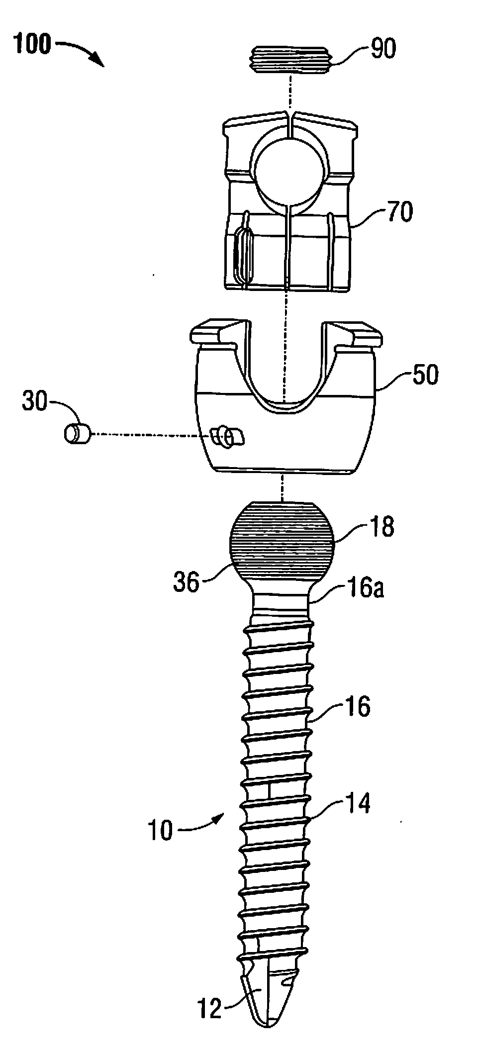 Multi-planar, taper lock screw with additional lock