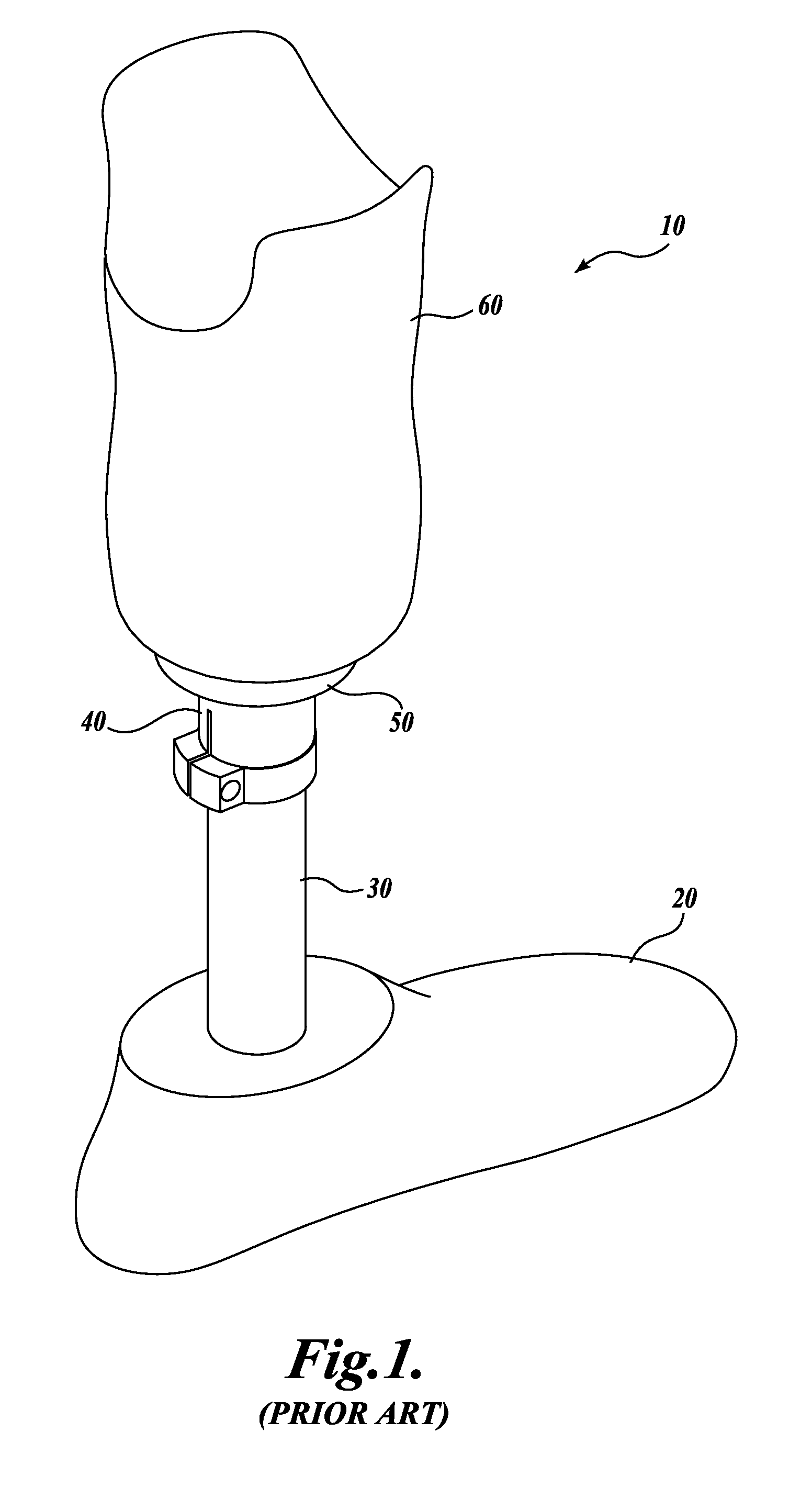 Method for aligning a prosthesis