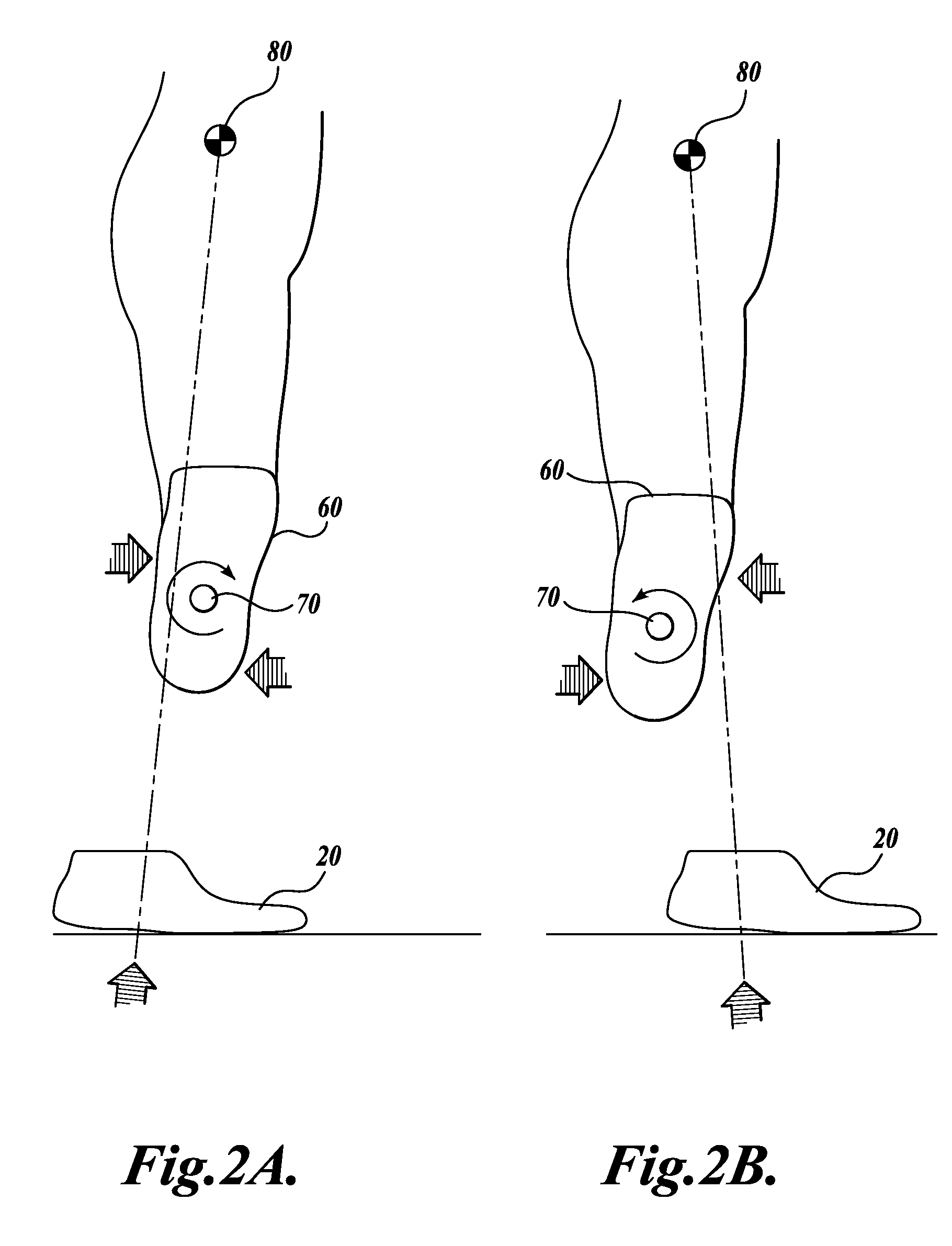 Method for aligning a prosthesis