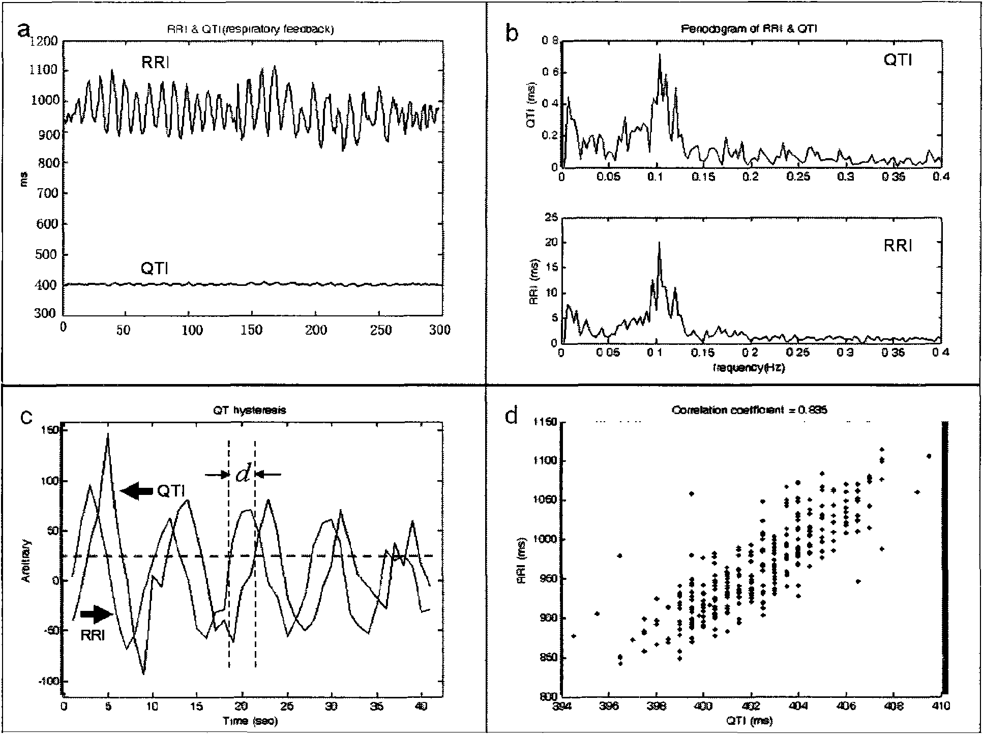 Method for building dynamic model of electrocardio signal RR interval and QT interval and applications thereof