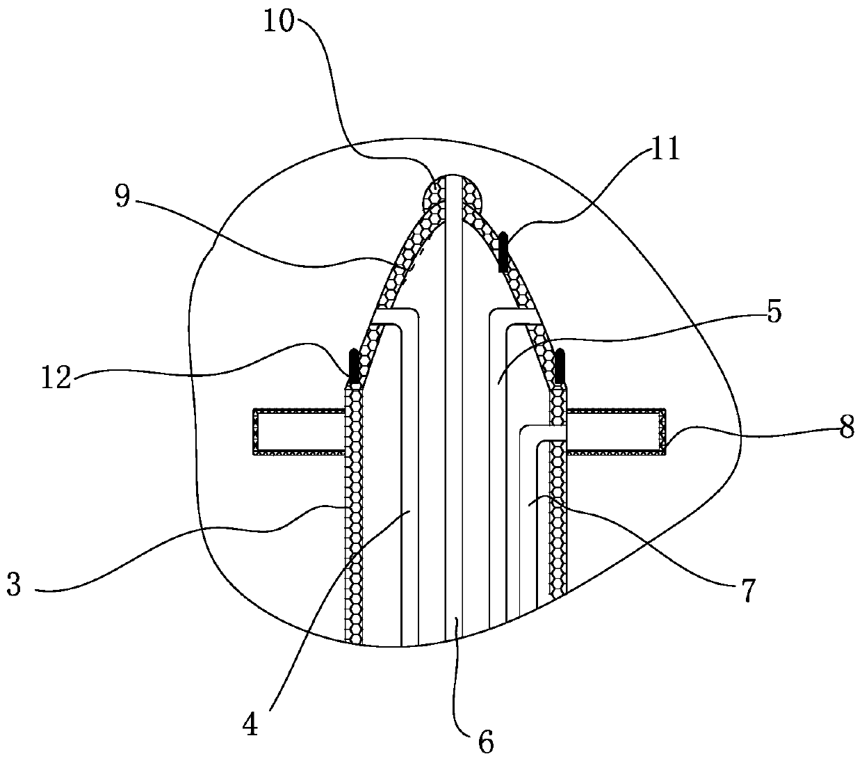 a ventilator