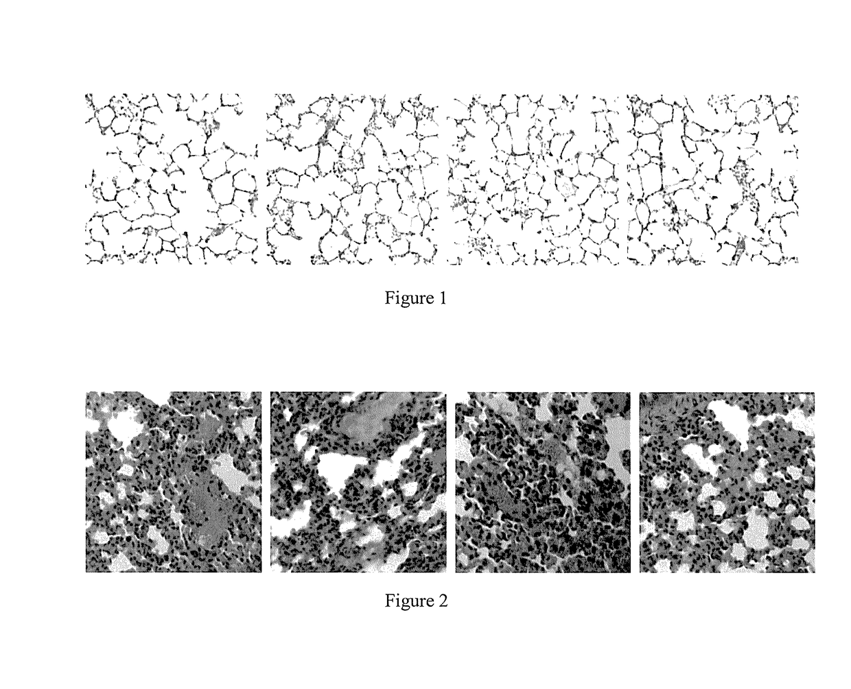 Method for treating pulmonary fibrosis comprising application of dimethylamino micheliolide