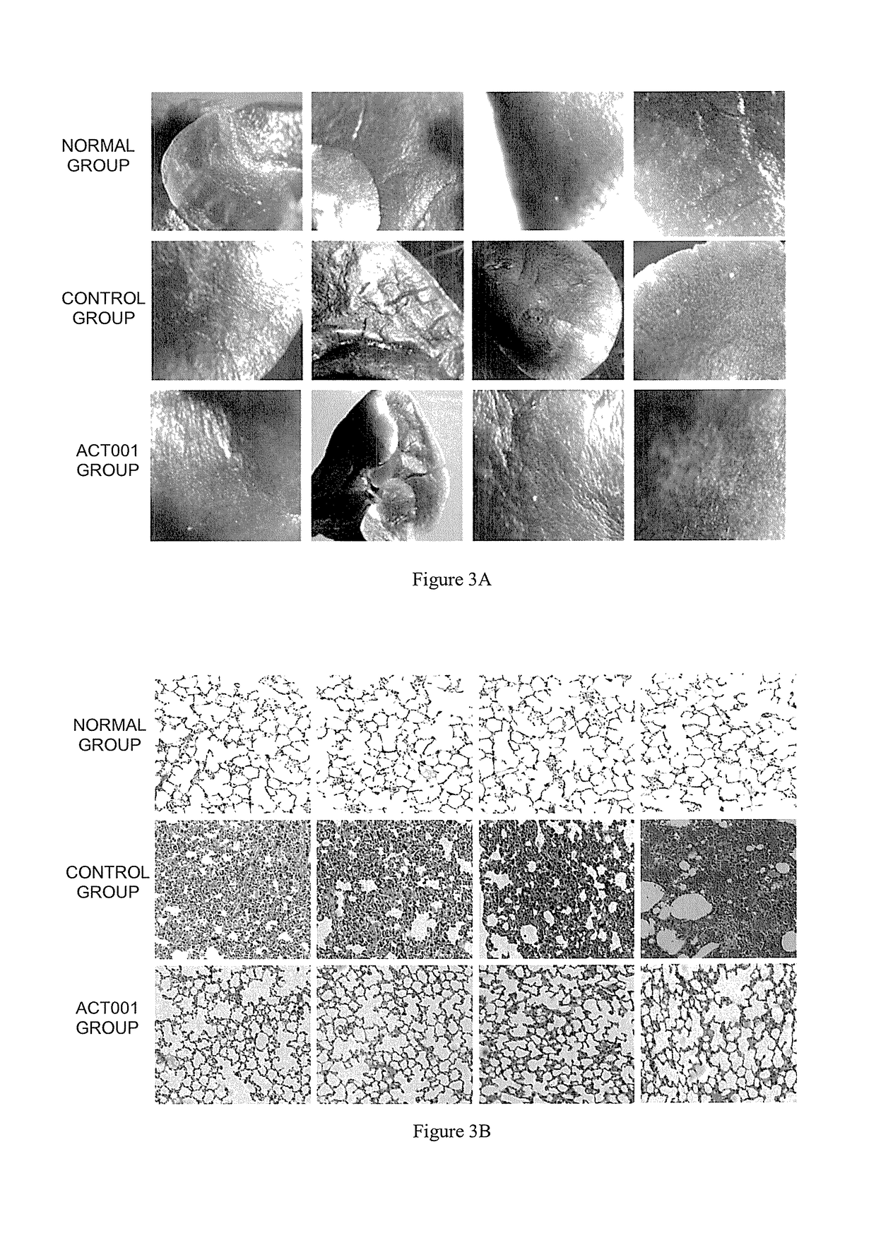 Method for treating pulmonary fibrosis comprising application of dimethylamino micheliolide