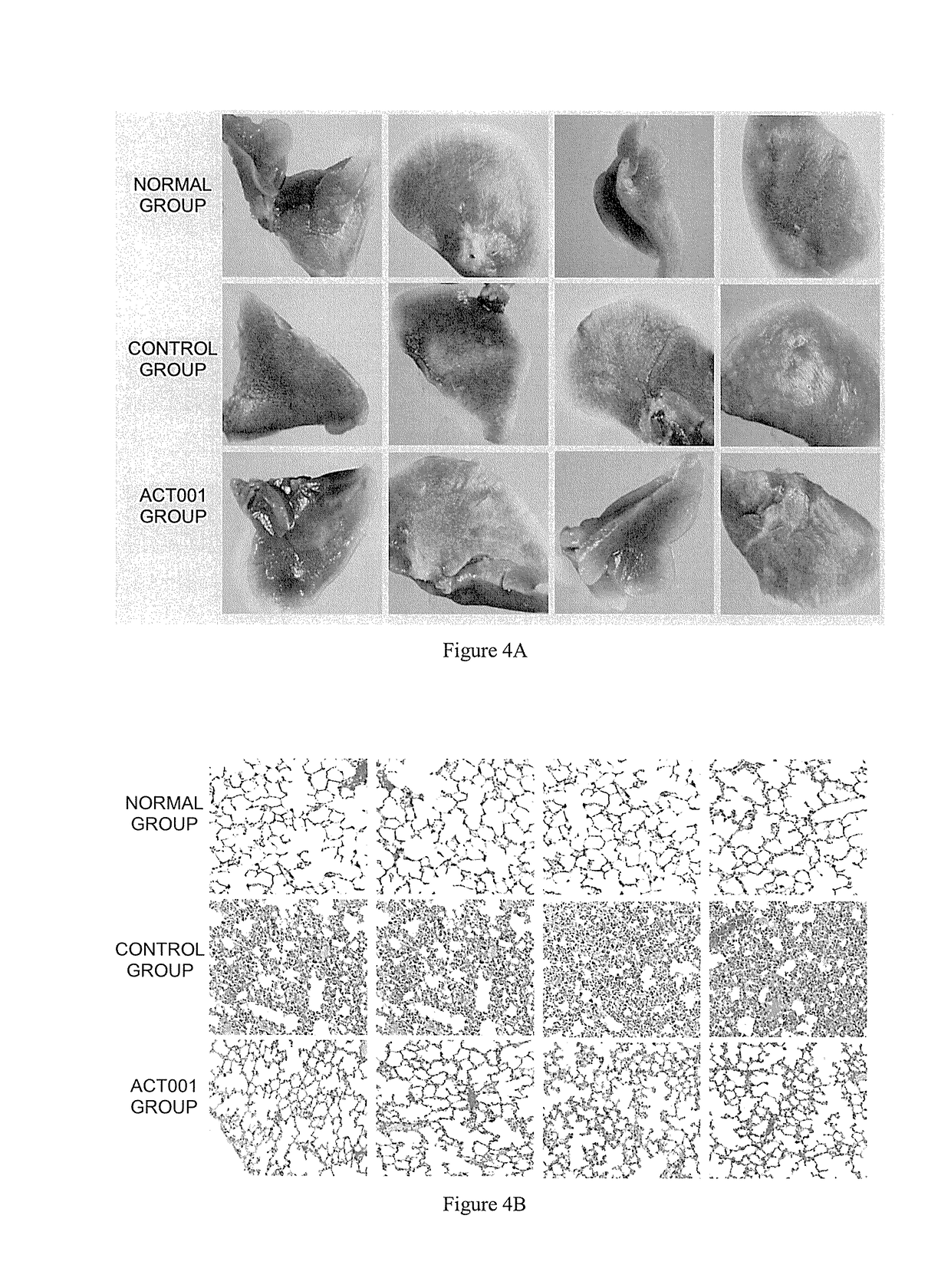 Method for treating pulmonary fibrosis comprising application of dimethylamino micheliolide