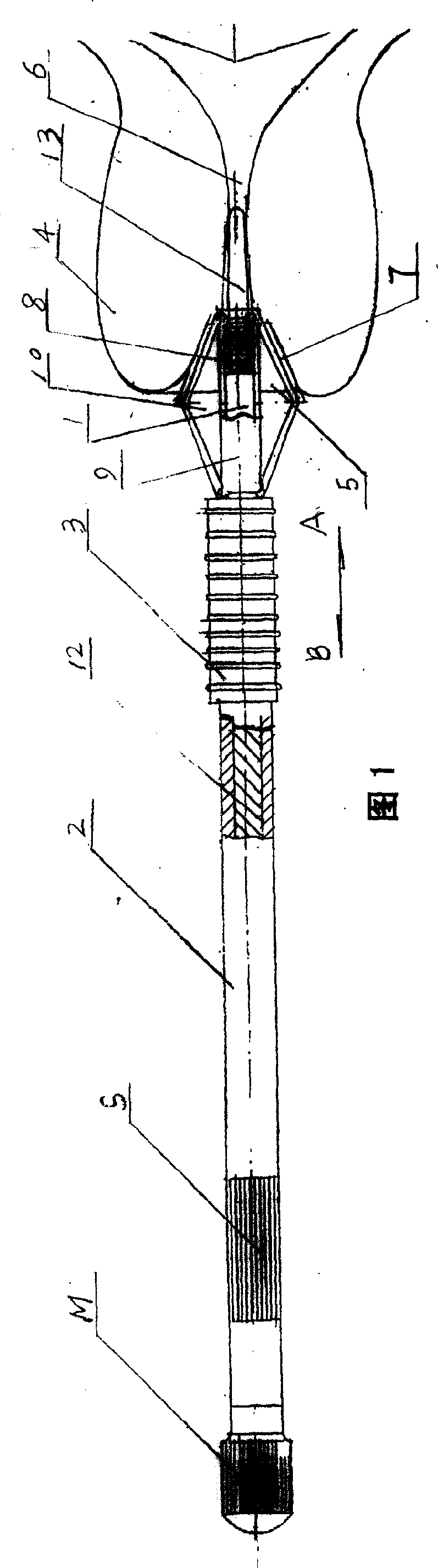 Uterine neck epithelial cell collecting equipment