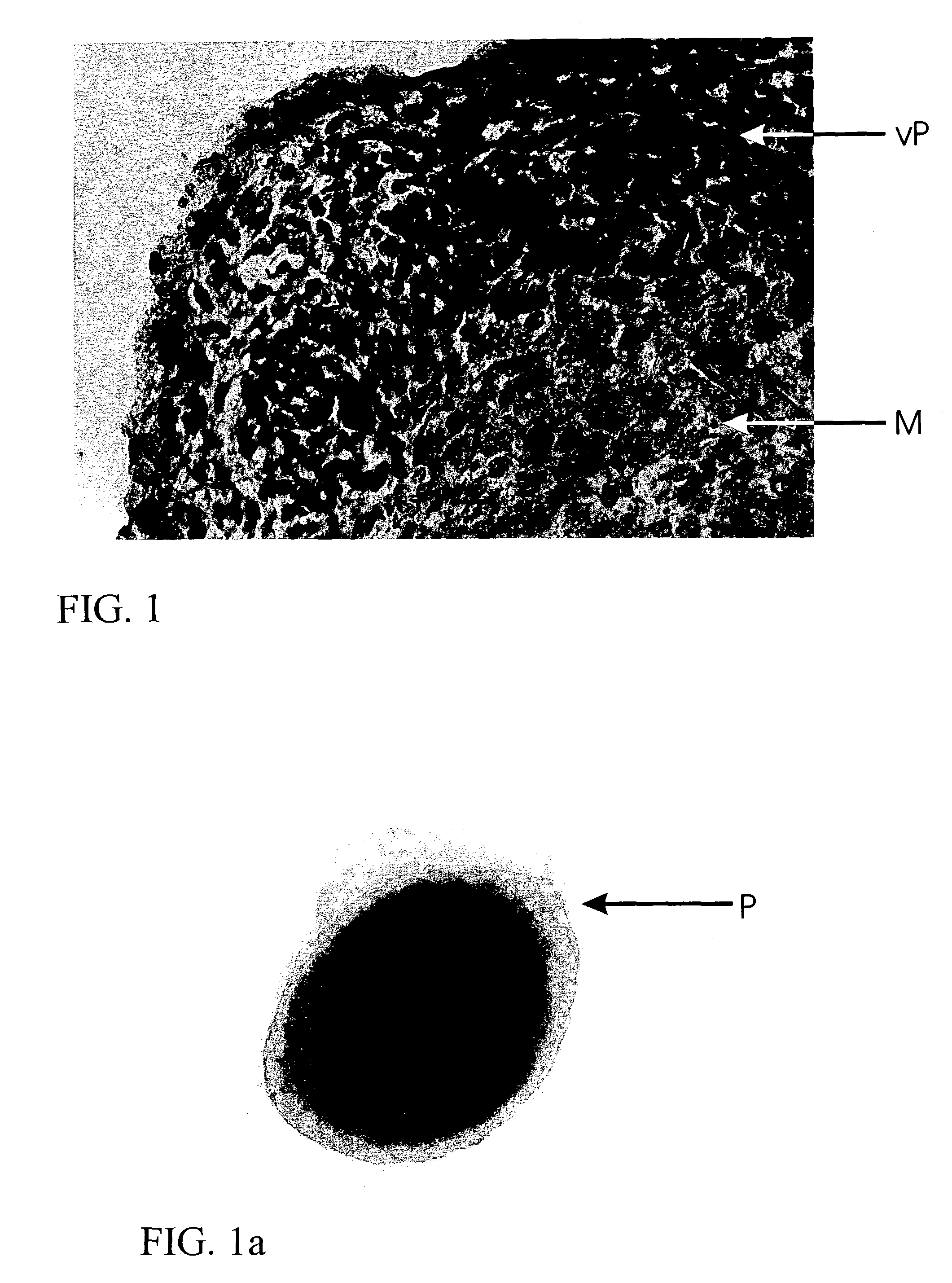 Method for in vitro production of three-dimensional vital cartilage tissue and use thereof as transplant material