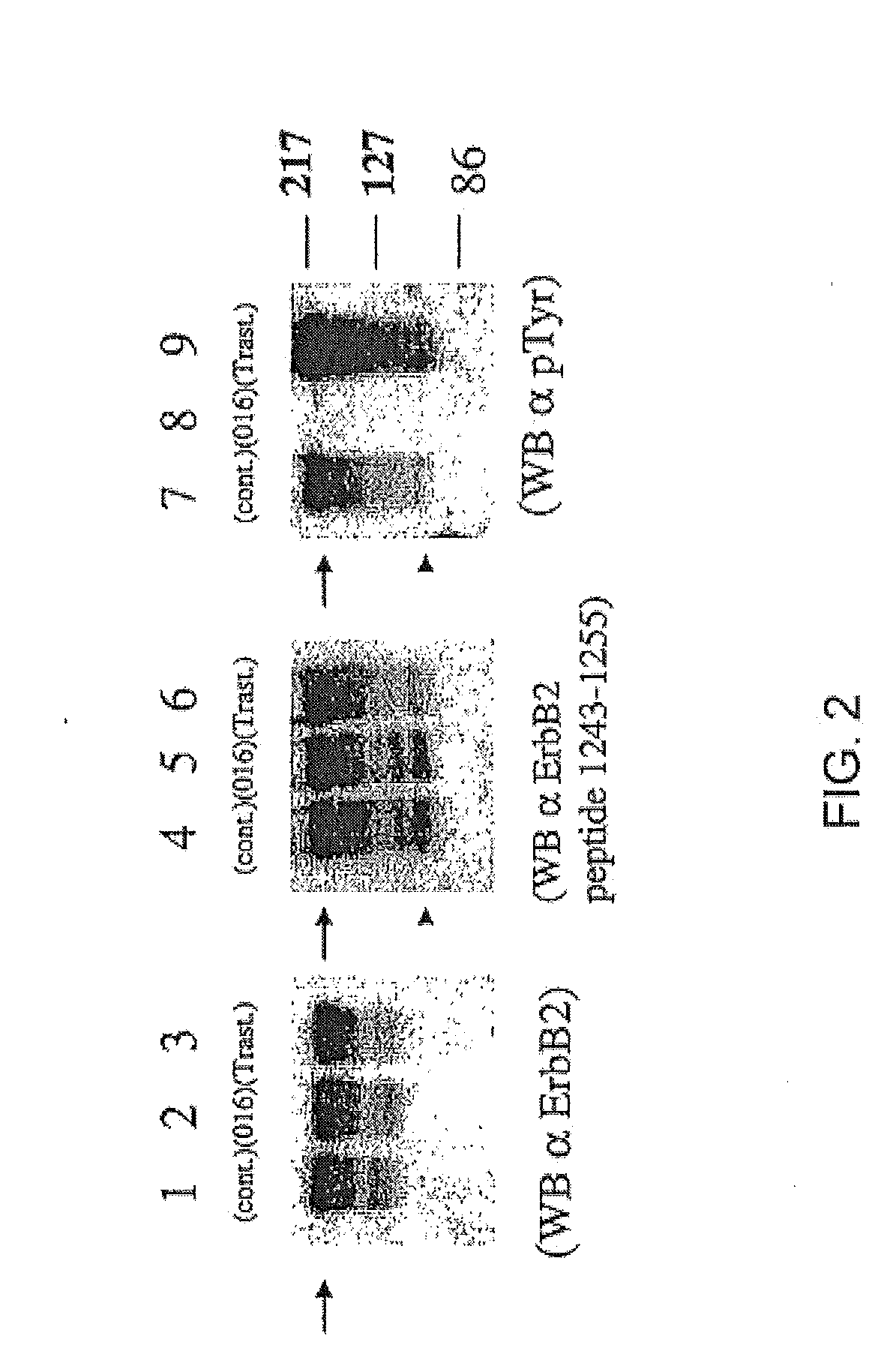 Treatment of Cancers Expressing p95 ErbB2