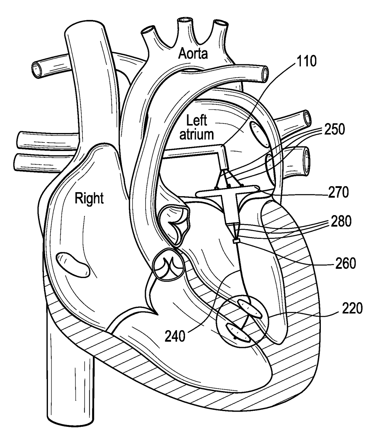 Delivery systems and methods for transcatheter prosthetic valves