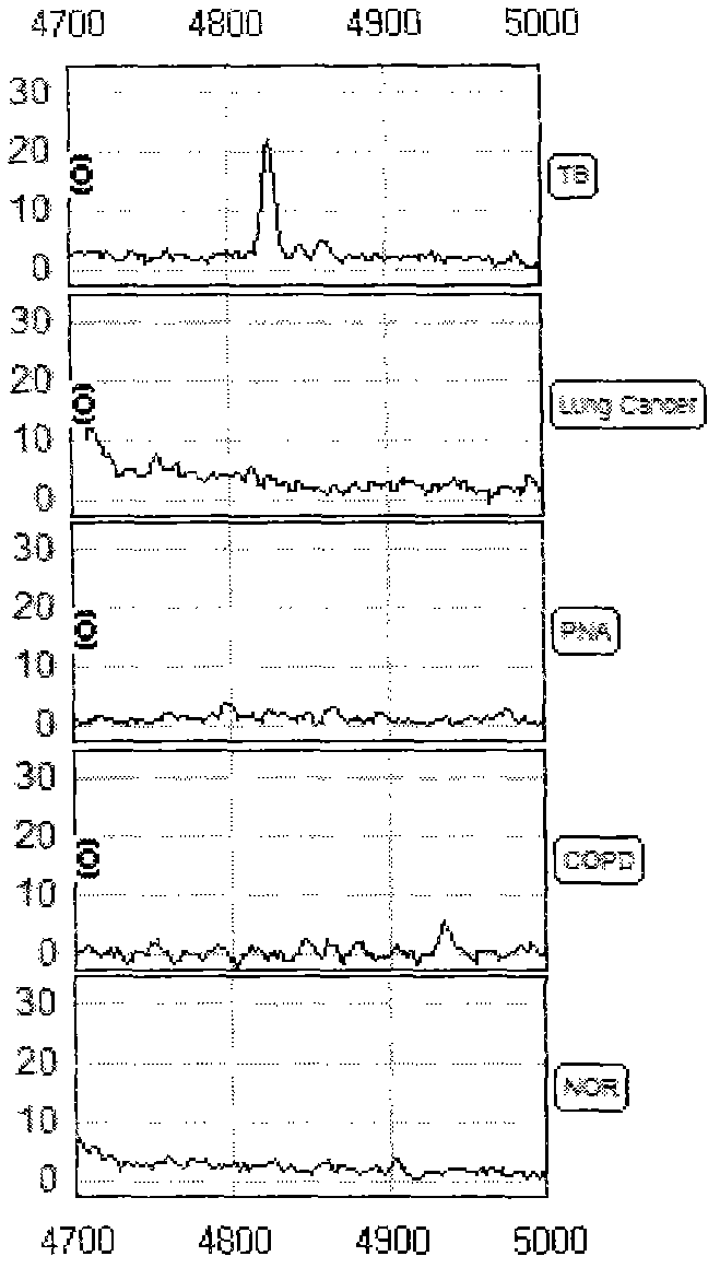 Sample containing tuberculosis serum characterized protein and preparation method thereof