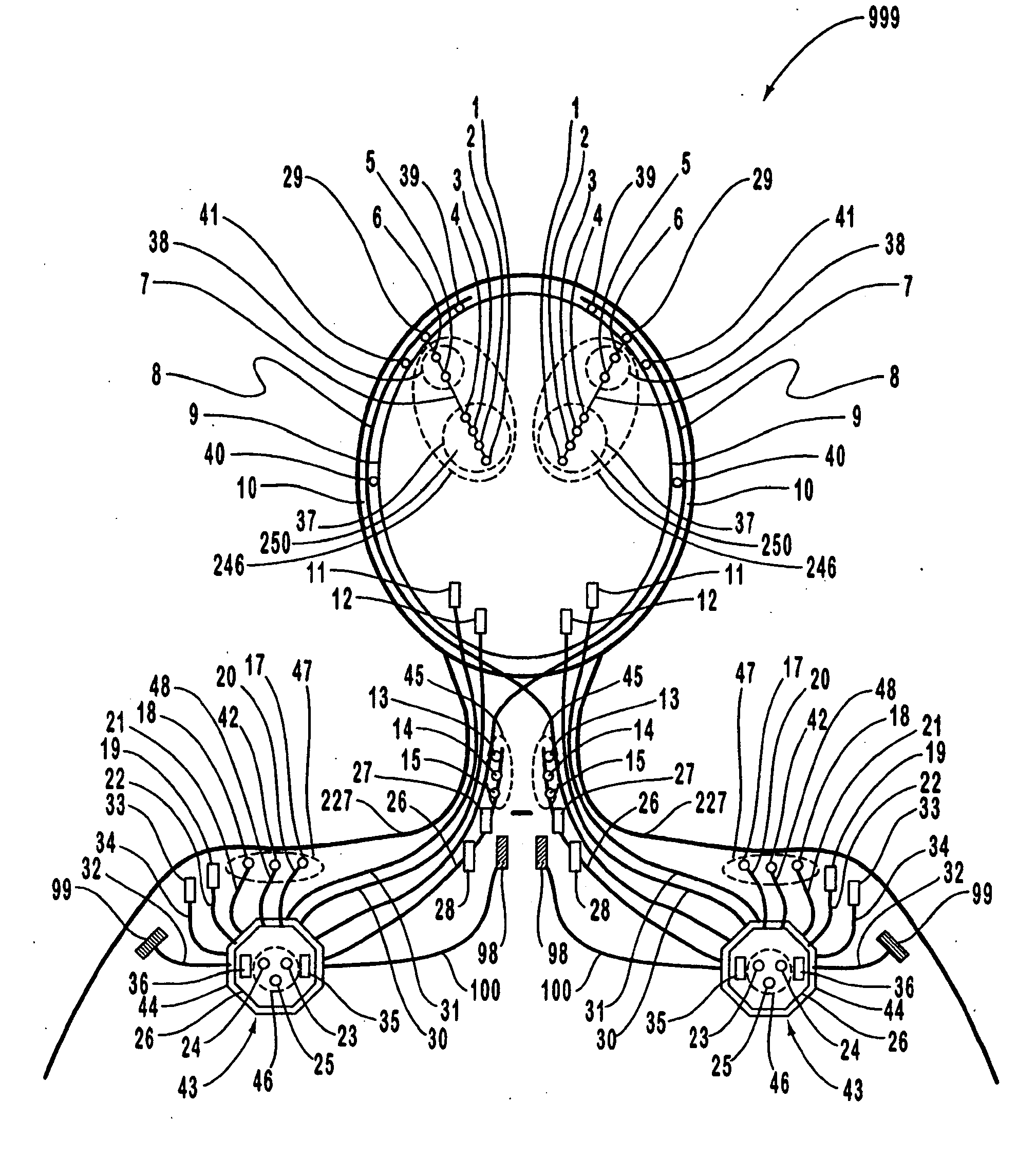 Systems and methods for monitoring a patient's neurological disease state