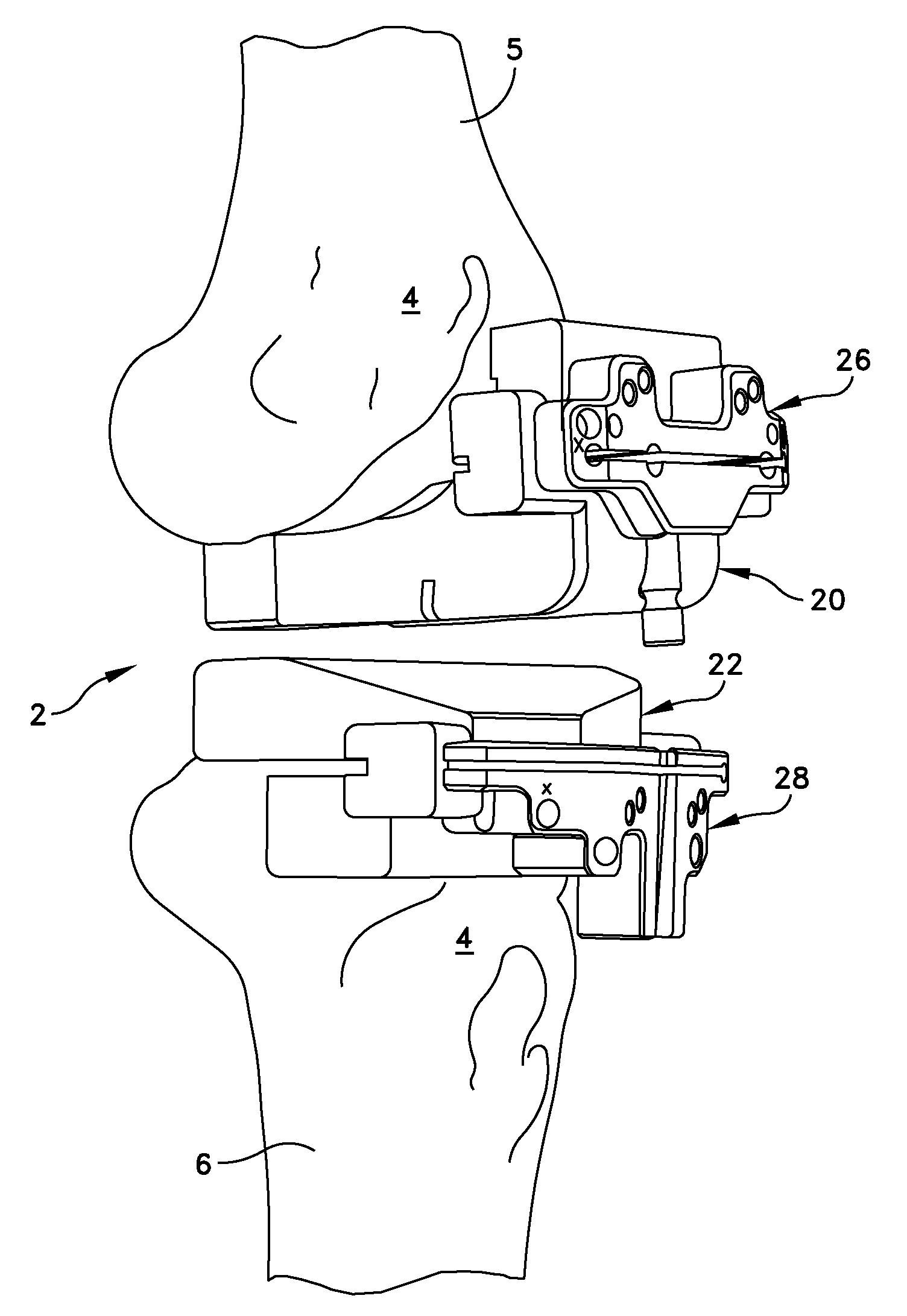 Method For Forming A Patient Specific Surgical Guide Mount