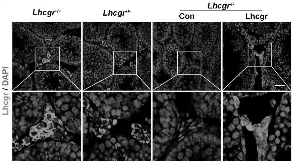 A kind of gene medicine and its application for treating the dysfunction of Leydig cells