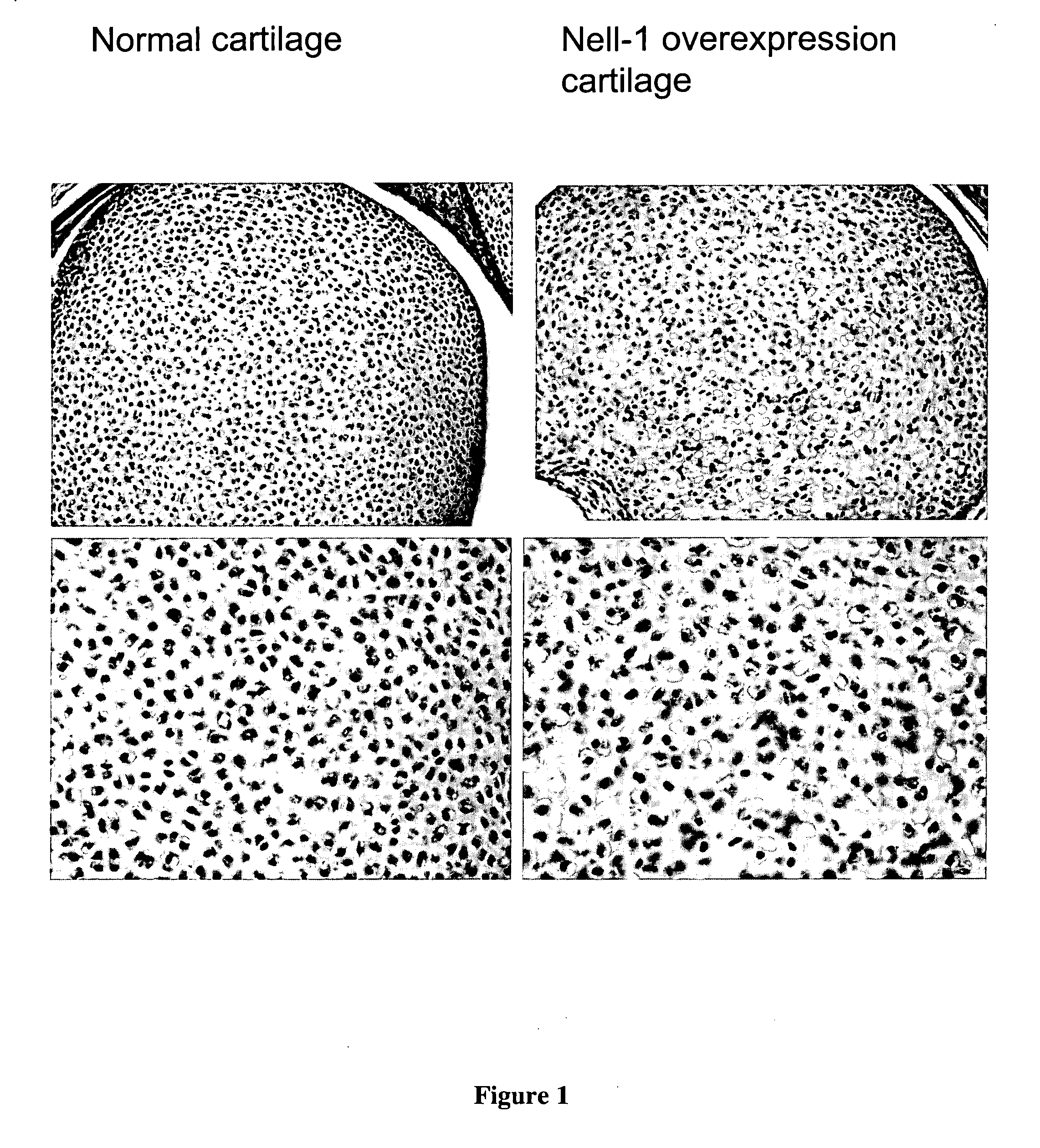 Composition for cartilage