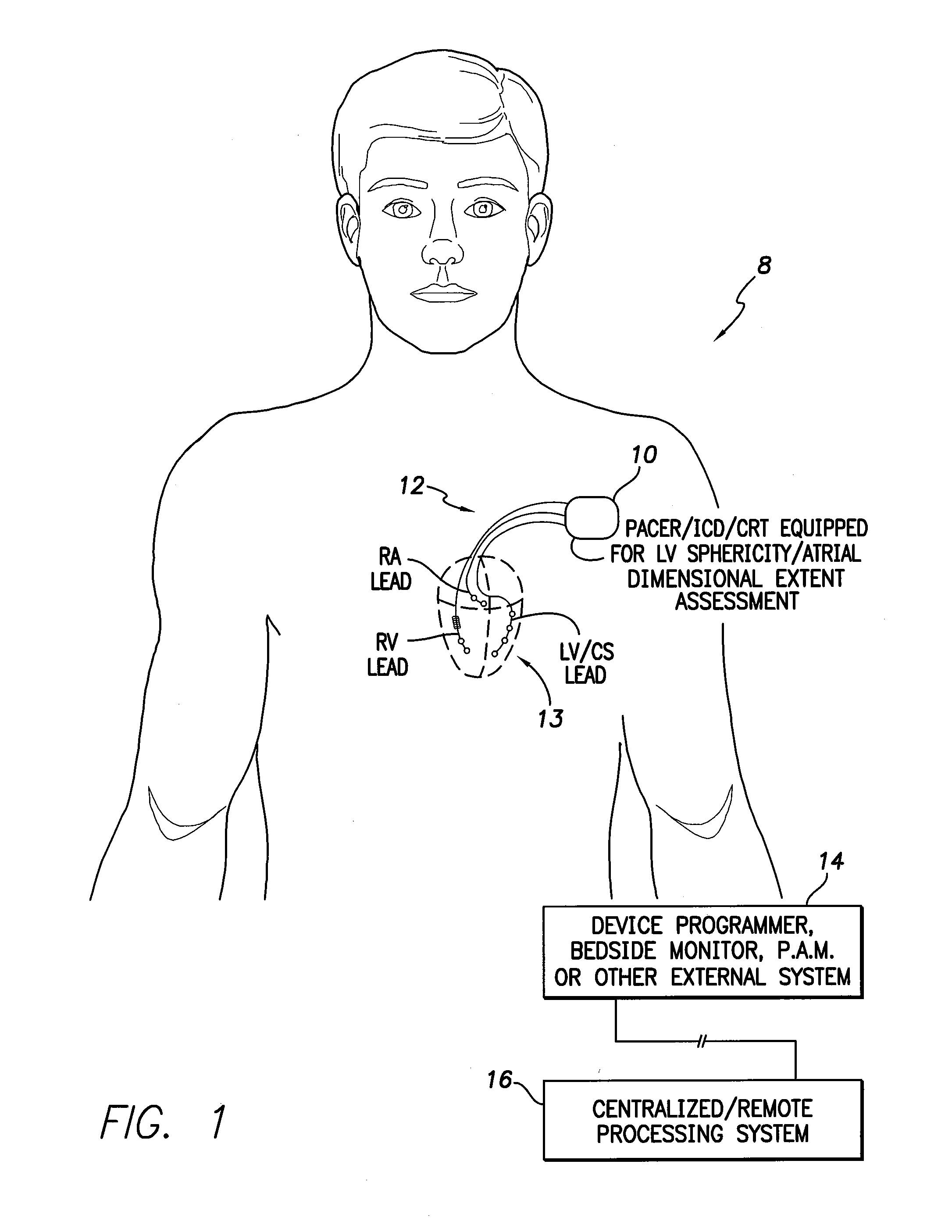 Systems and methods for assessing the sphericity and dimensional extent of heart chambers for use with an implantable medical device