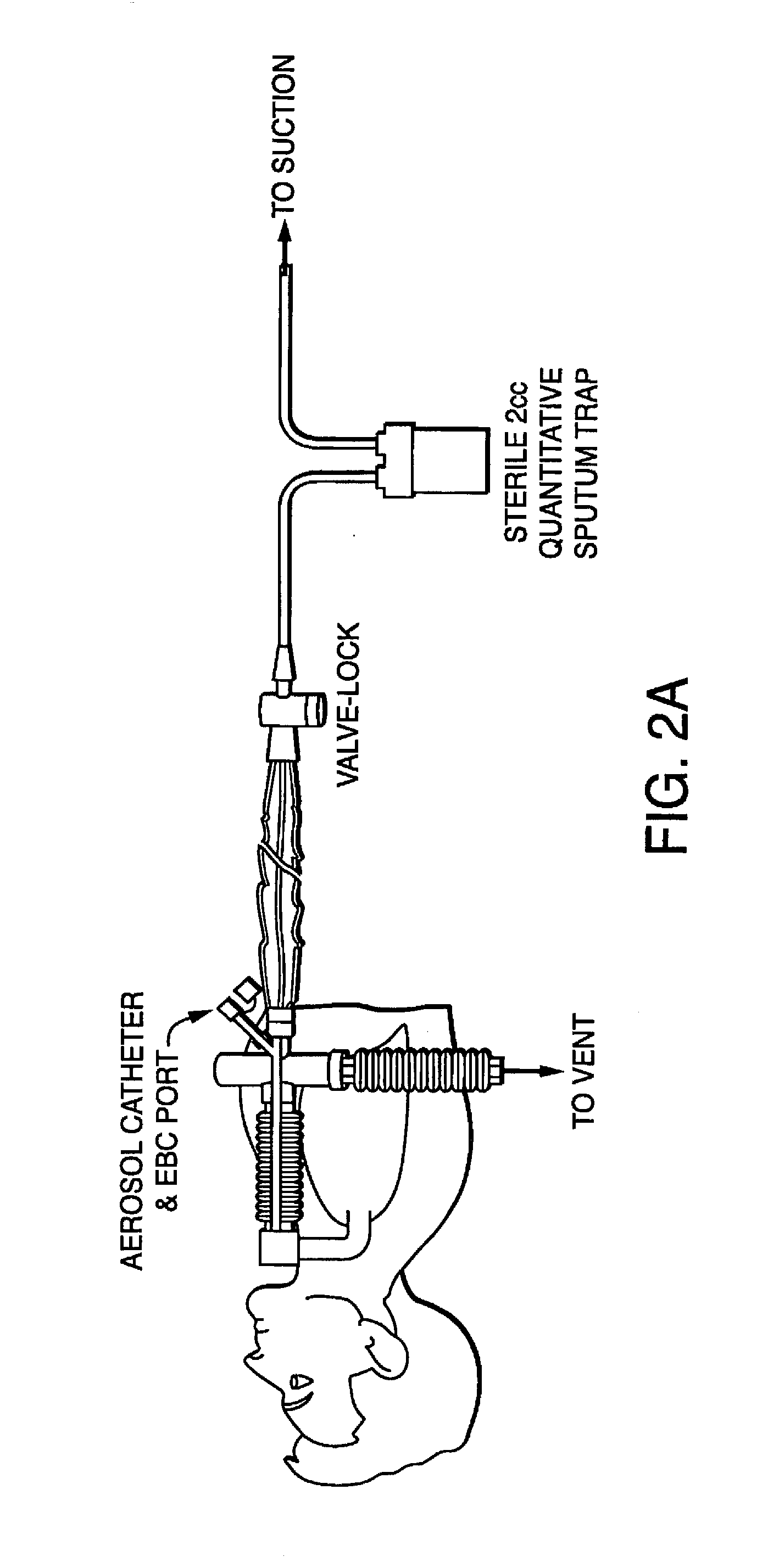 Methods, Devices and Formulations for Targeted Endobronchial Therapy