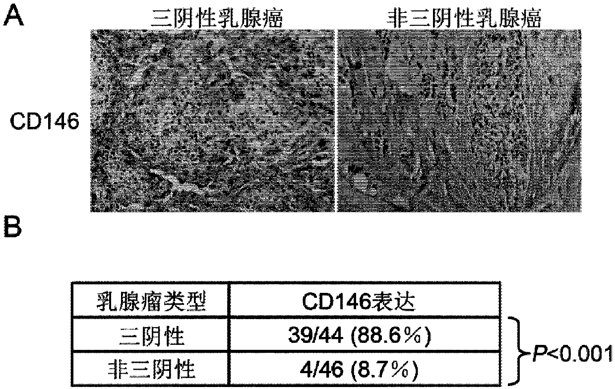 Application of CD146 and its antibody in diagnosis and treatment of triple negative breast cancer