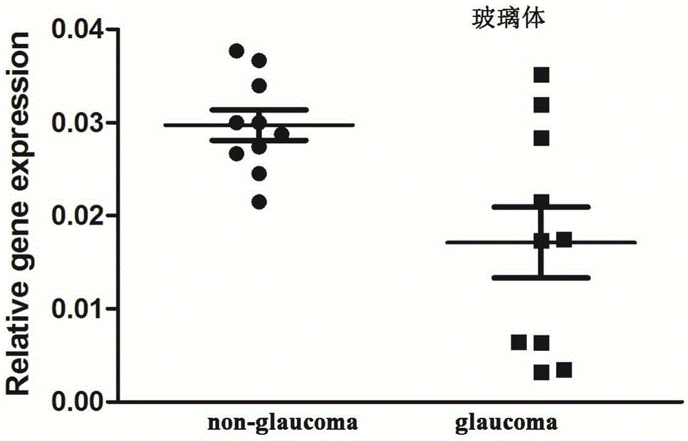 Application of LncRNA-GAS5 in preparing glaucoma diagnosis reagent