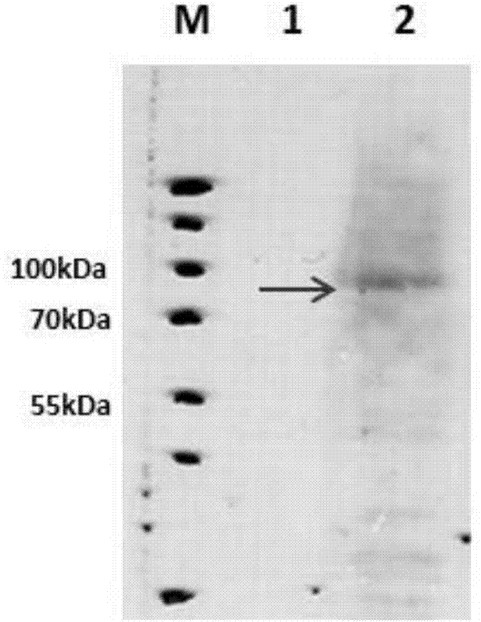 TgVP1 extracellular region antigen polypeptide, anti-TgVP1 polyclonal antibody and application of polyclonal antibody