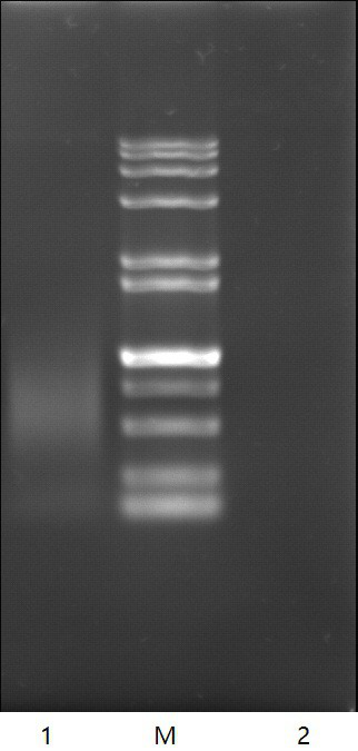 Mixed carbon source induced pichia pastoris expression recombinant batroxobin and purification method thereof